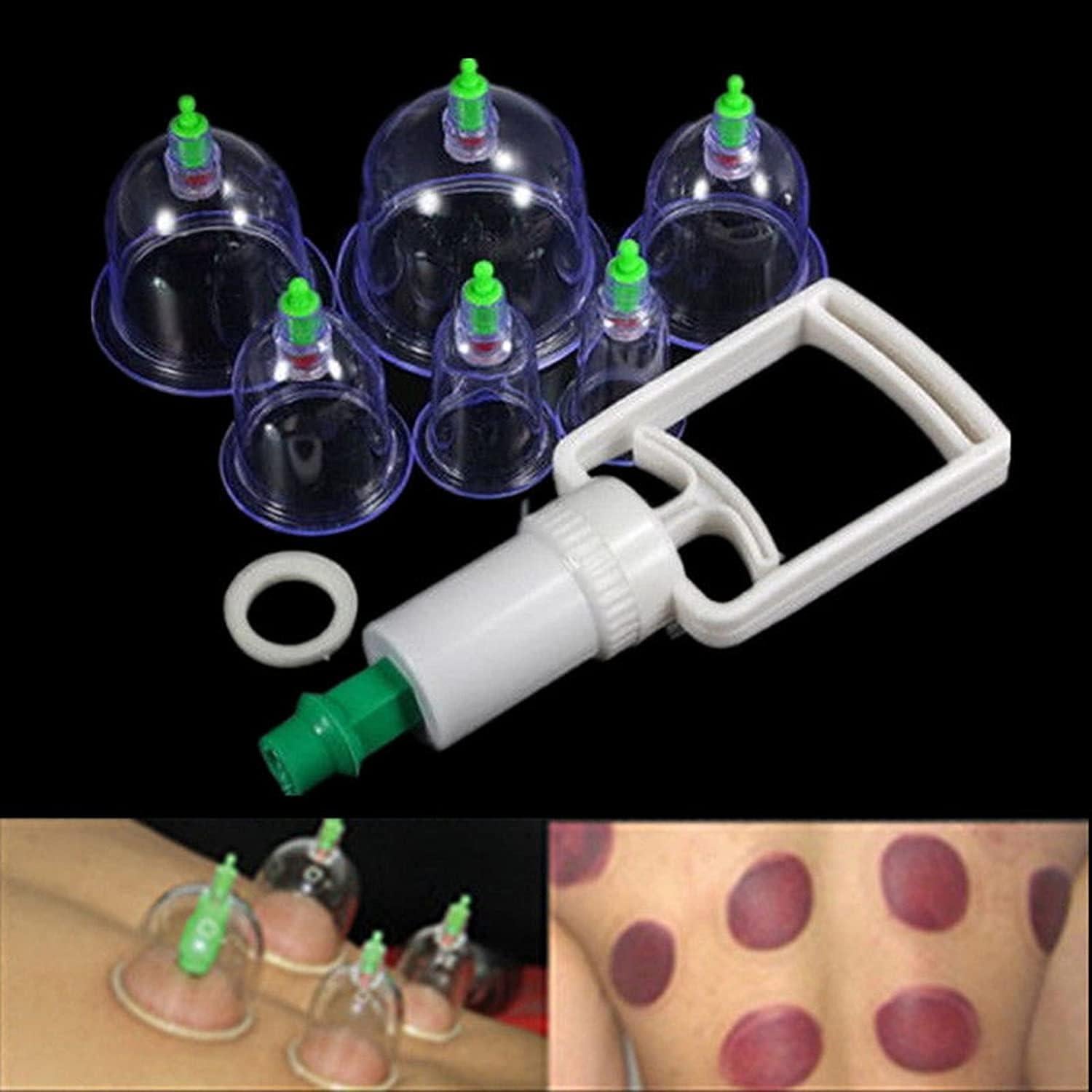 Juego de Ventosas Chinas XGNB para Masaje Terapéutico - 6 Tazas