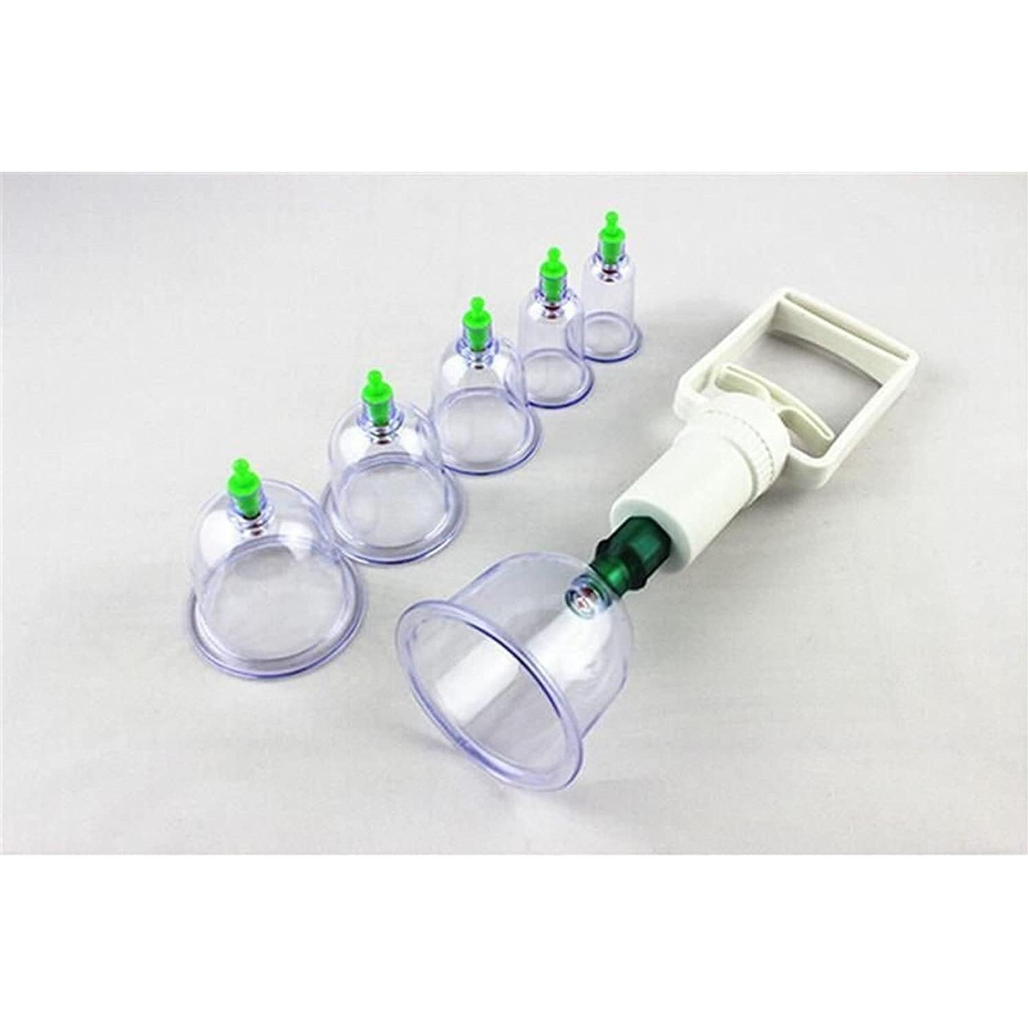 Juego de Ventosas Chinas XGNB para Masaje Terapéutico - 6 Tazas