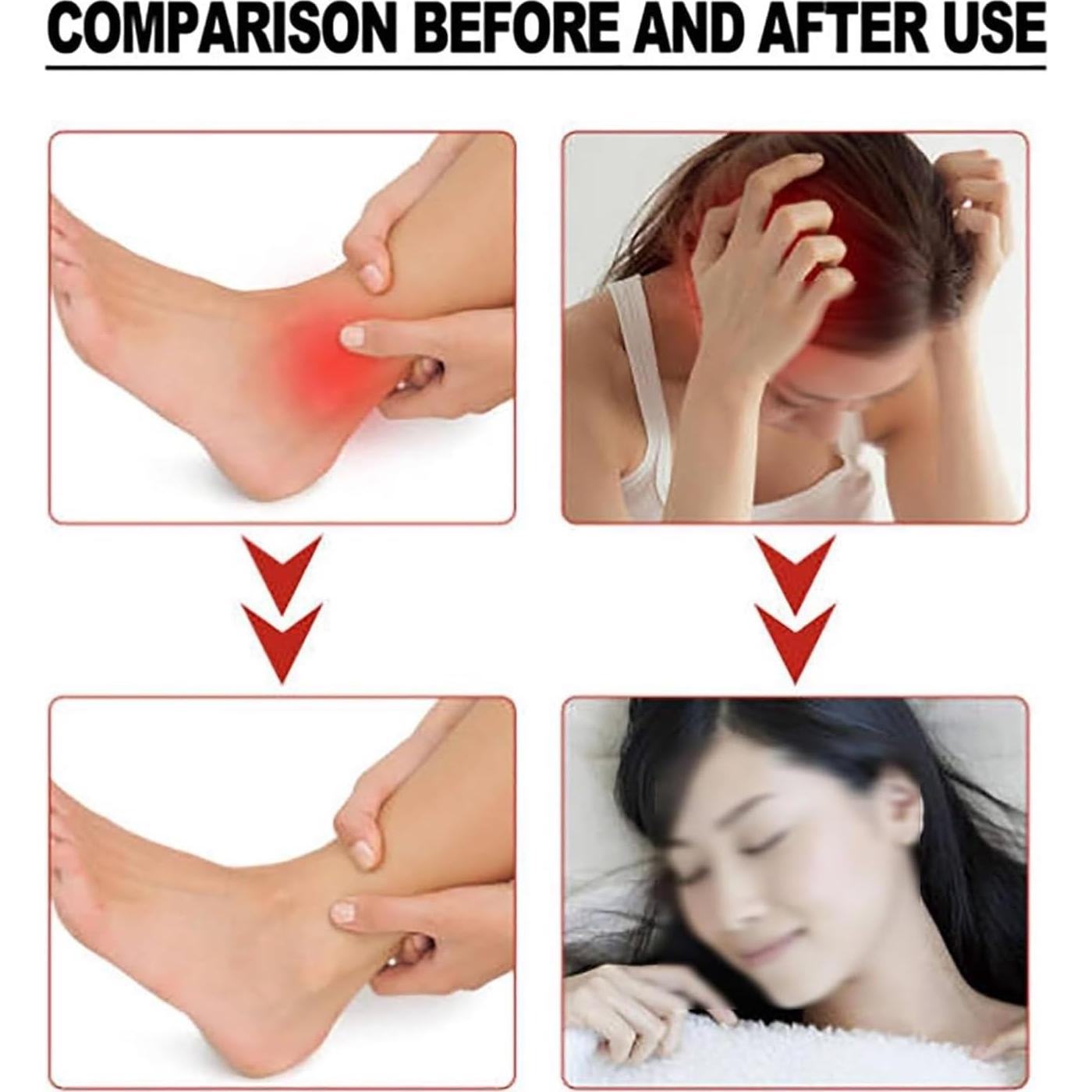 Etiquetas de Acupuntura JRVT 14pcs por Caja - 3 Cajas