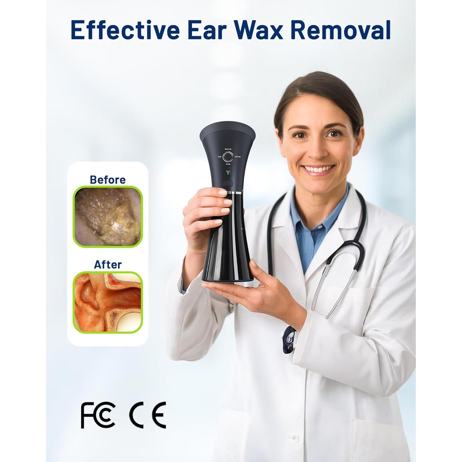 Removedor de Cera de Oído KAUGIC CSJ-001 con Tanque de Desechos