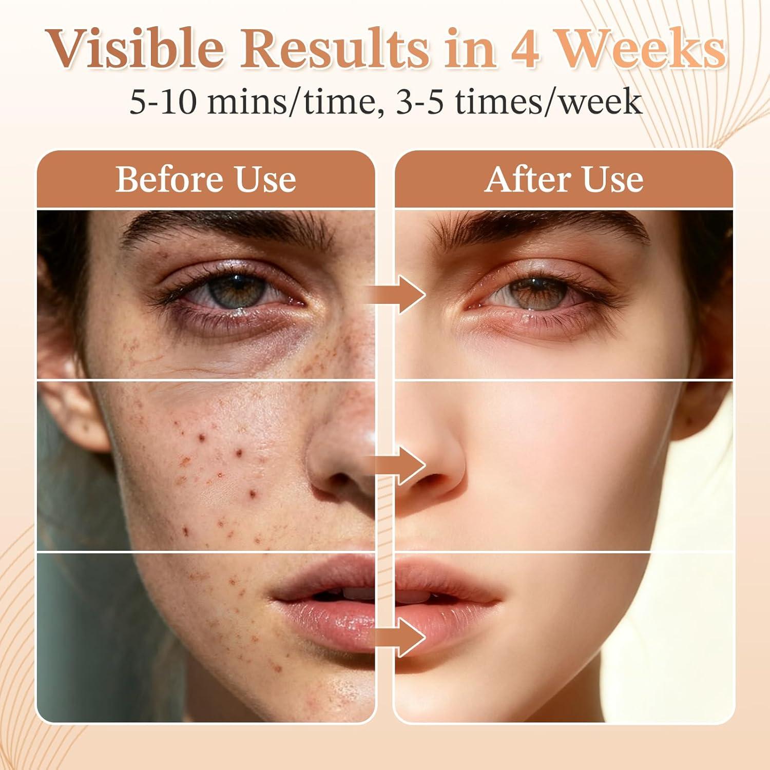 Máscara de Terapia de Luz Roja FDA 850nm para la Cara - Belleza