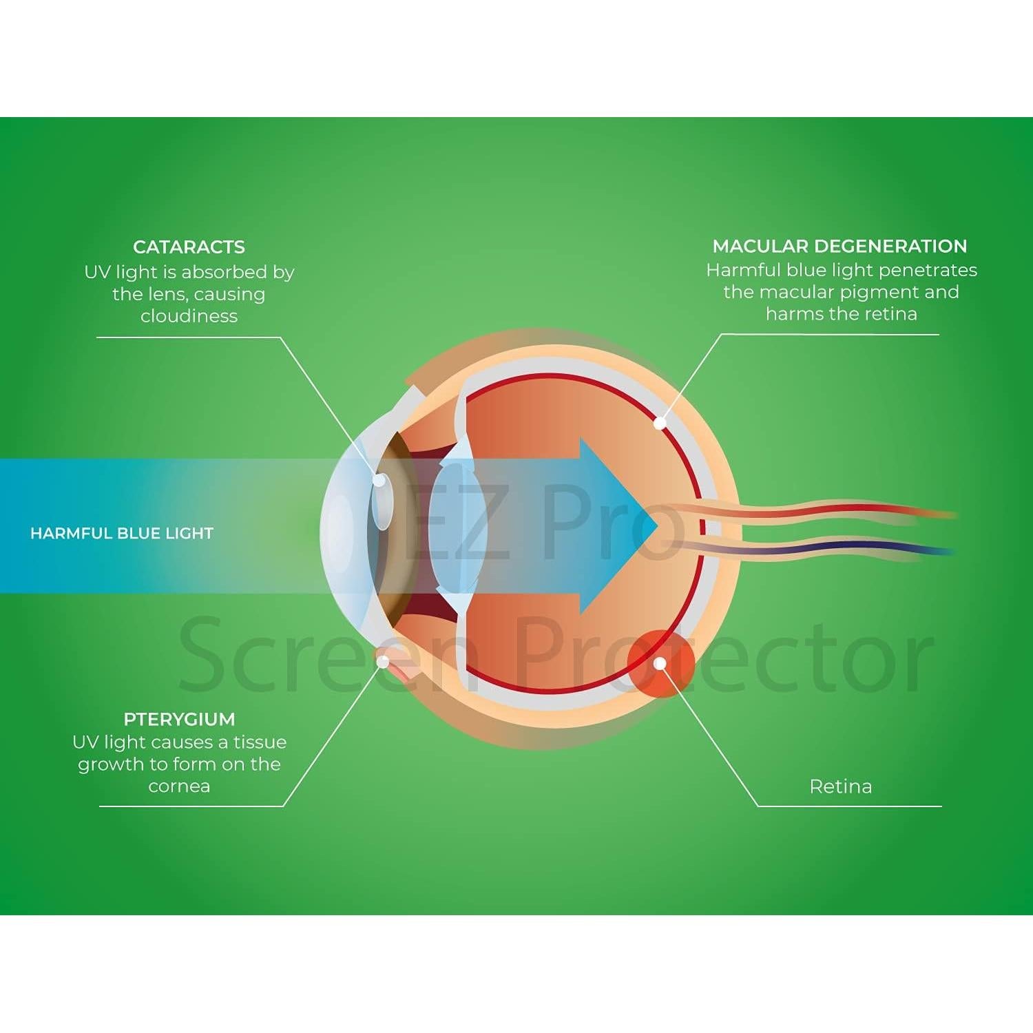 Protector de Pantalla Anti Luz Azul EZ-Pro 27" (2 Unidades)