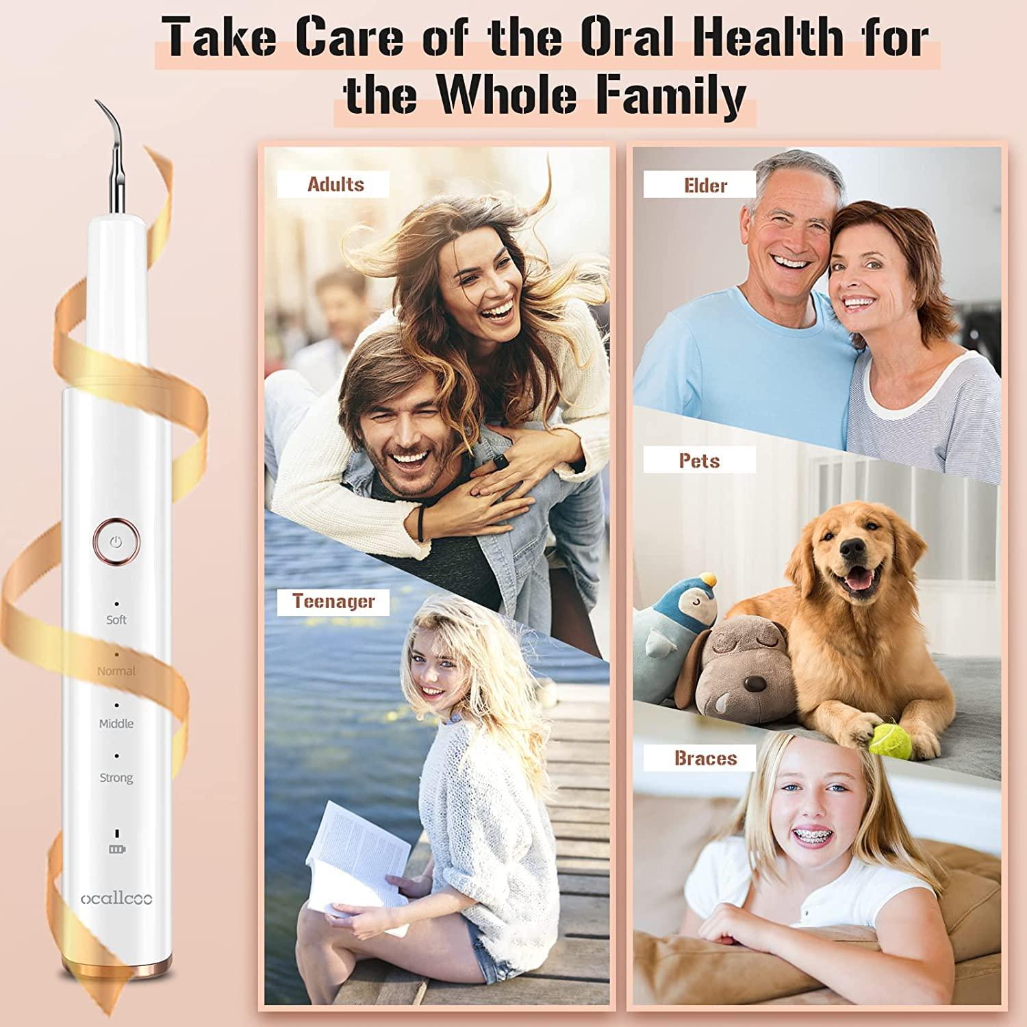 Removedor de Placa Dental Eléctrico Ocallcoo con Luz LED