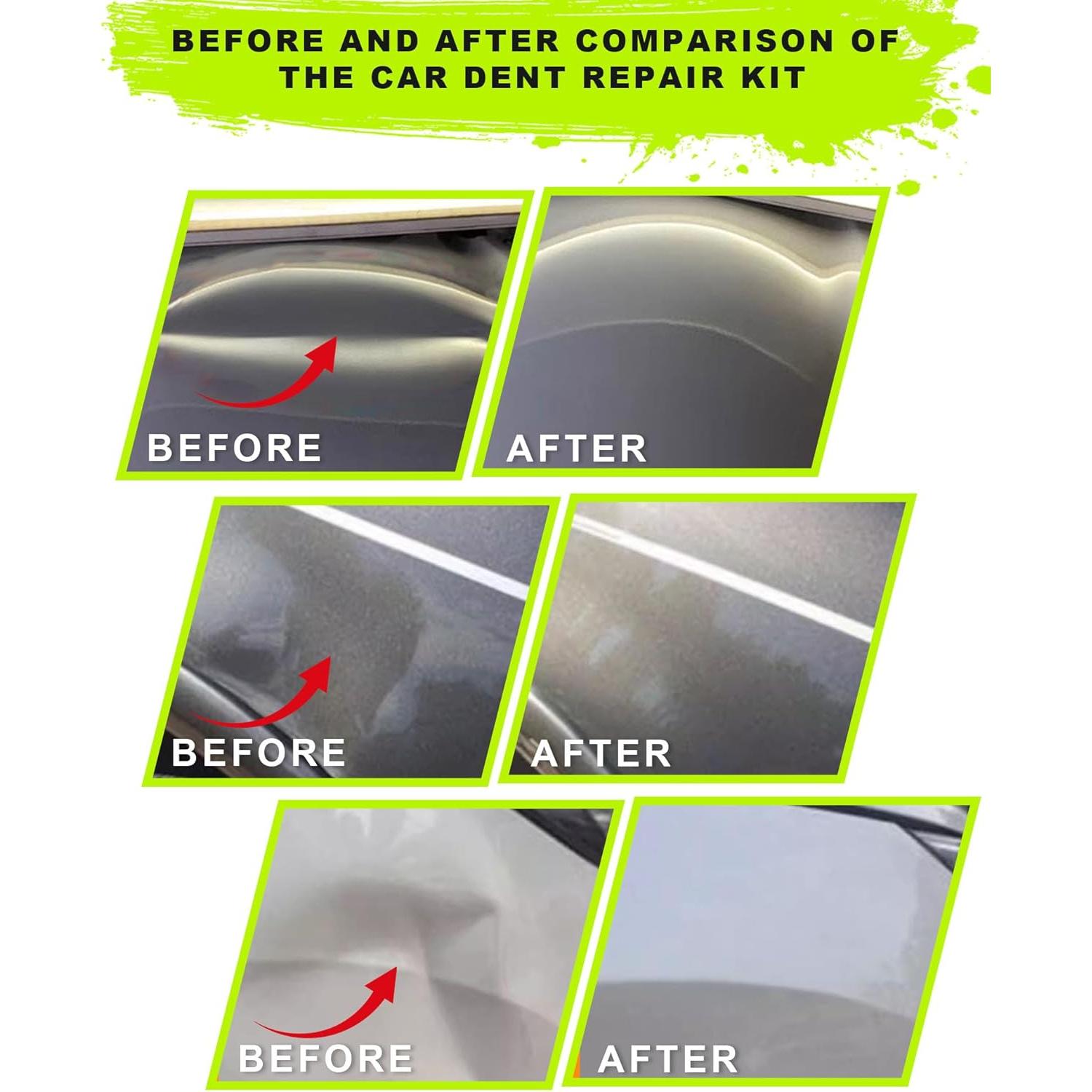 Kit de 22 Piezas para Quitar Abolladuras Beautiebeam