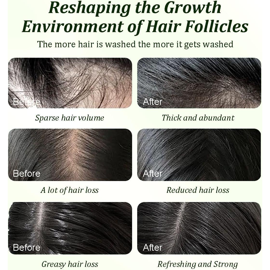 Champú de Aceite de Batana y Romero Gypsophila 600 ml 2 Pack