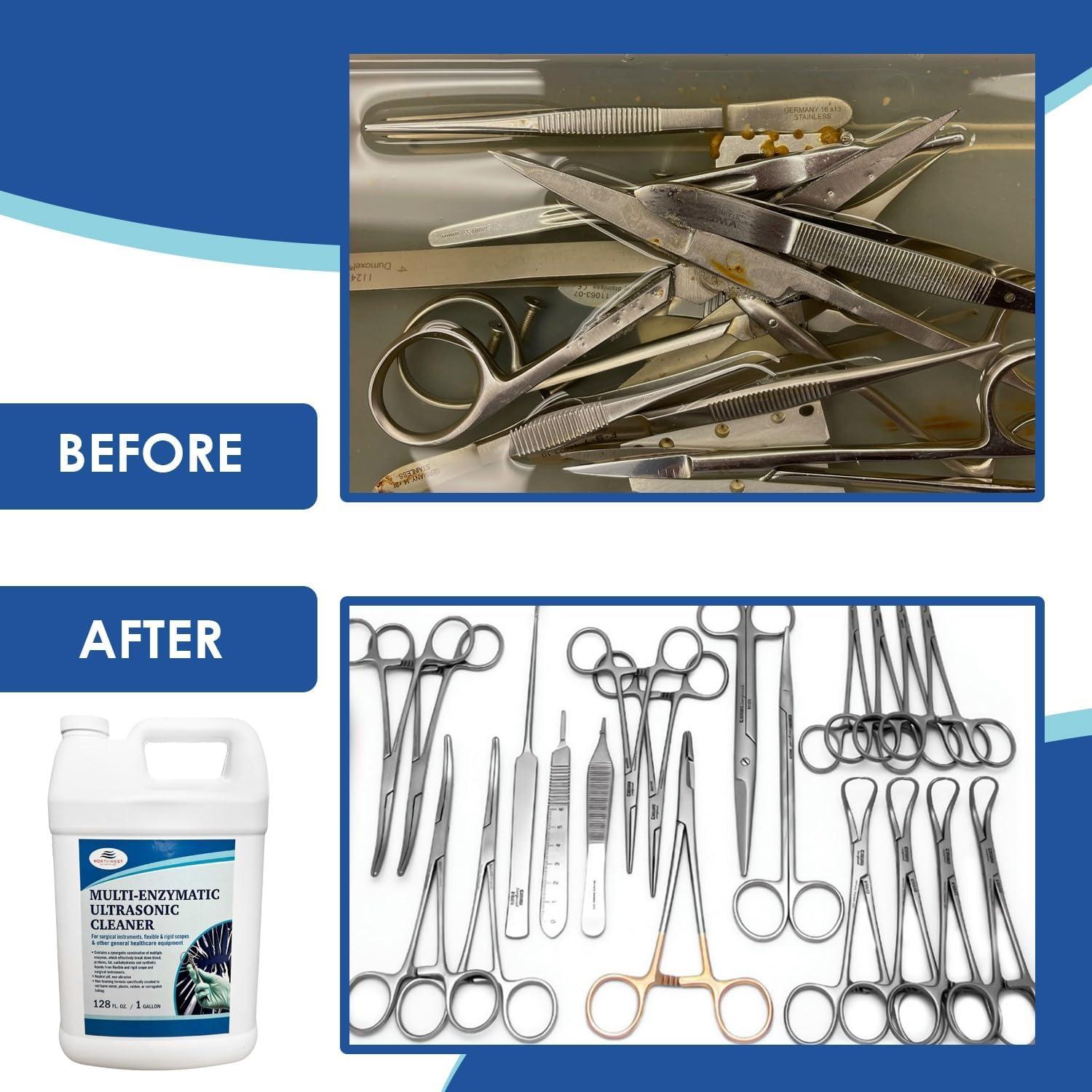 Limpiador Enzimático Ultrasónico Northwest Enterprises 3.91kg