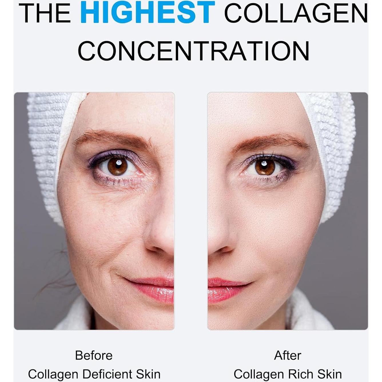 Mascarilla Facial de Colágeno SOYUB - Hidratante Nocturna 4 pcs