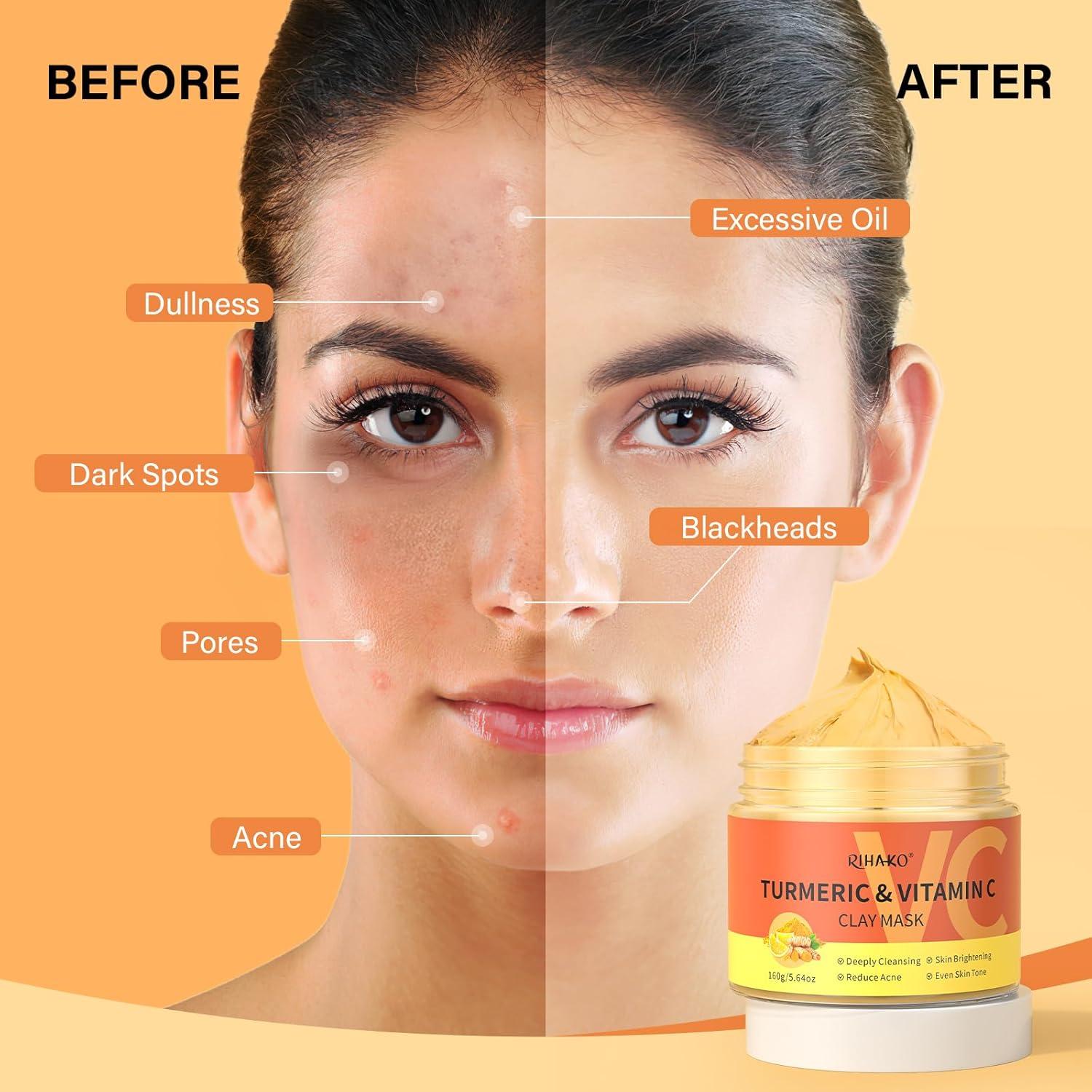 Mascarilla Facial de Arcilla RIHAKO con Vitamina C y Cúrcuma 221g