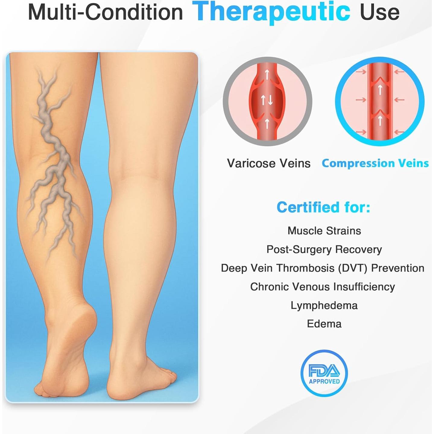 Faja de Compresión para Muslos XL Feamero - Alivio Hinchazón