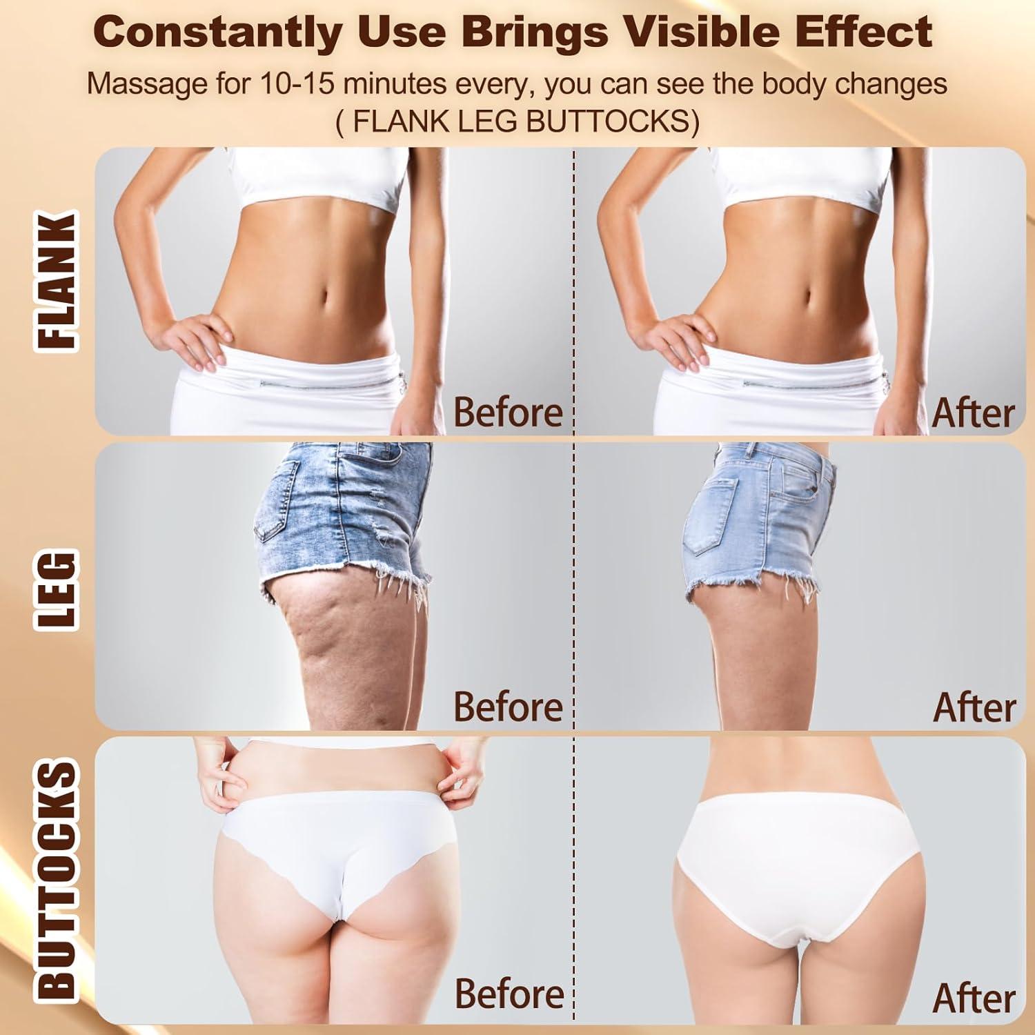 Masajeador Drenaje Linfático Lemonforts LDM-05 Inalámbrico 30 Niveles