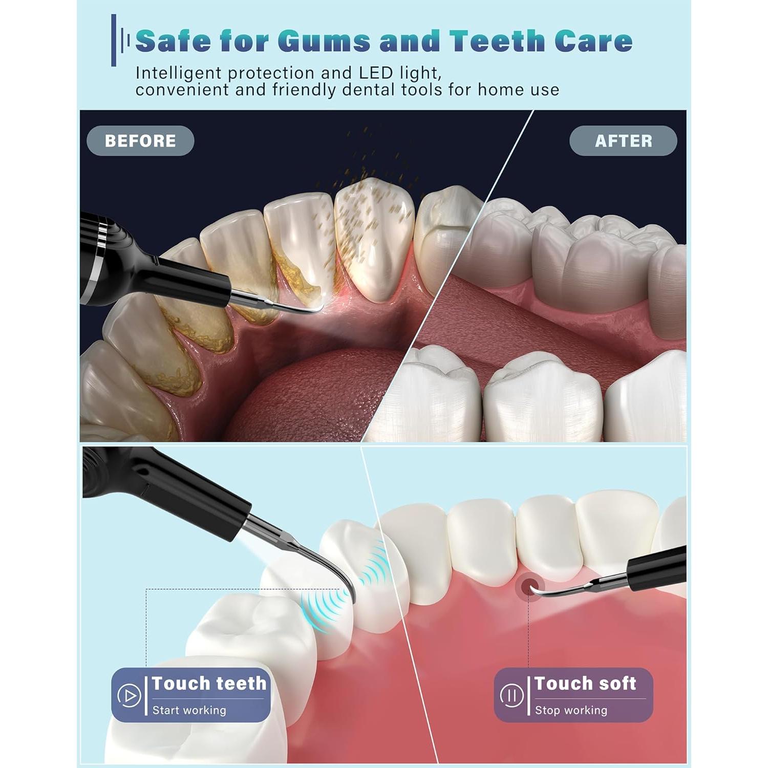 Removedor de Placa Dental Nature Nerds WD-JY-W001 con Luz LED