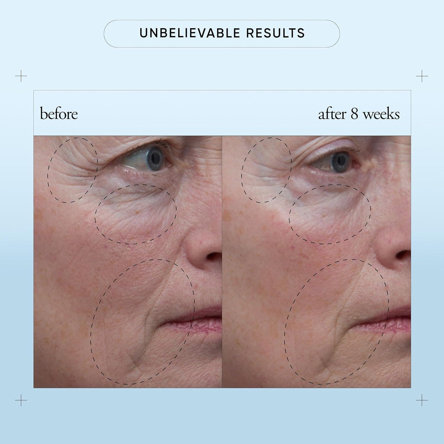 Suero Facial Reafirmante Filosofía 29.57 ml - Vitamina C, E y Ácido Hialurónico