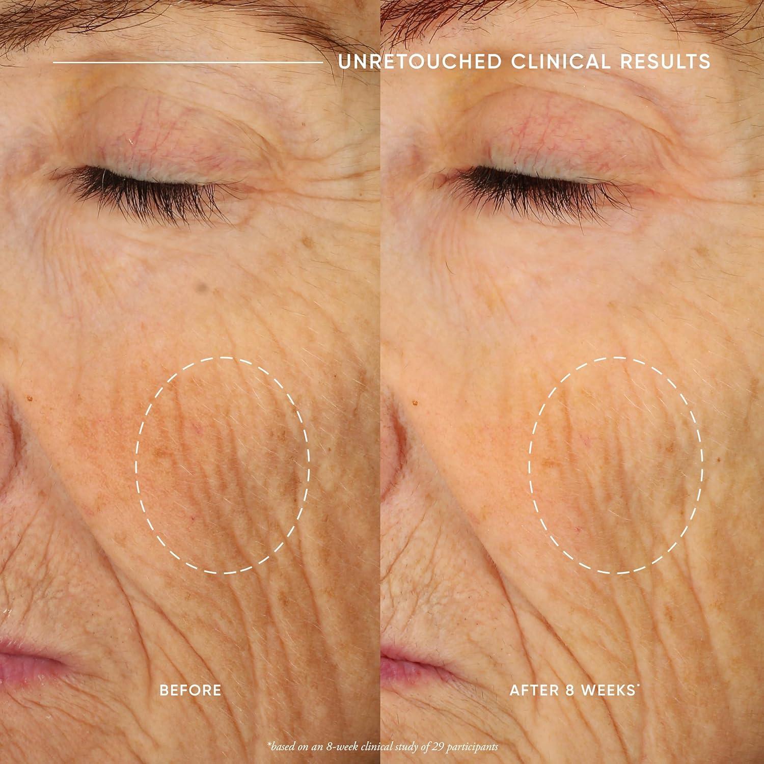 Crema Facial Philosophy Ultimate Miracle Worker 56.7g - Hidratante con Retinol y Ceramidas