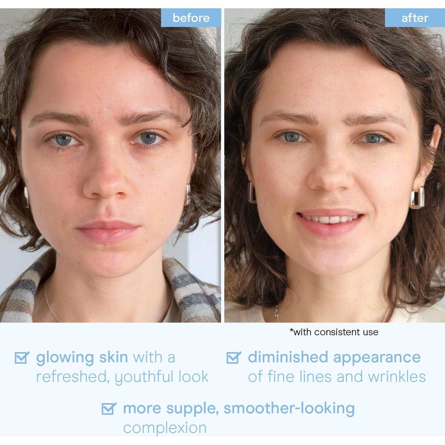 Mascarilla Facial Baebody 6 Pcs Hidratante Antienvejecimiento