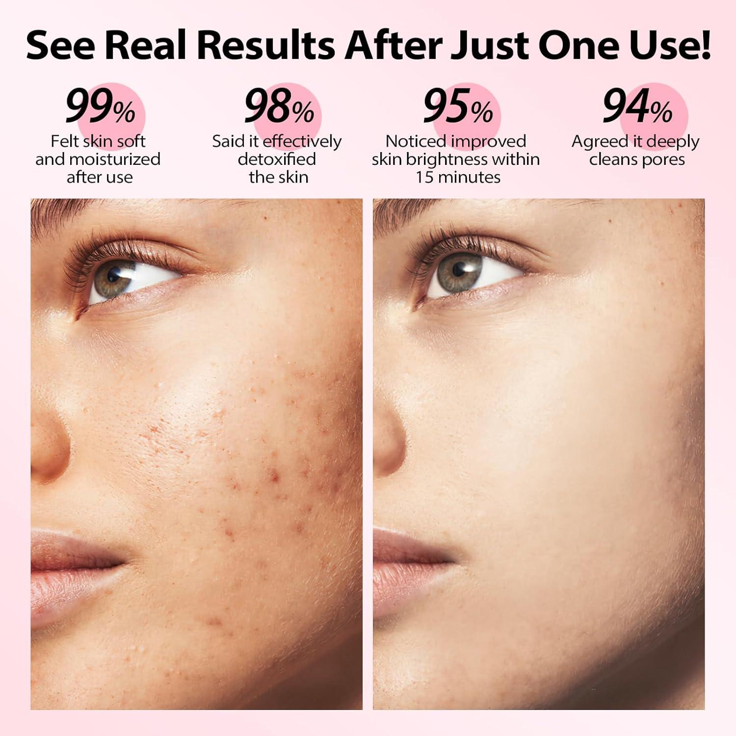 Juego de 3 Mascarillas Faciales YLNALO - Arcilla y Cúrcuma