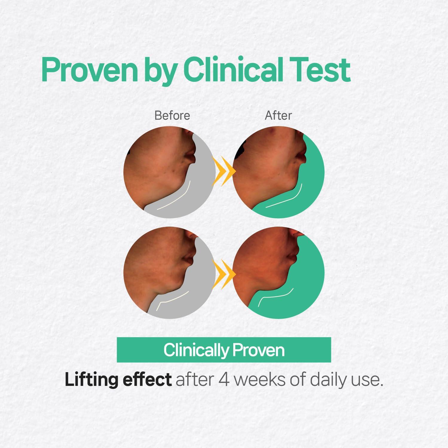 V Line Face Lifting Collagen Sleeping Mask 4ct – Double Chin Reducer & Neck Wrinkle Patches with Hyaluronic Acid & Vitamin E, Chin Strap Care, Neck Lift Tape Overnight