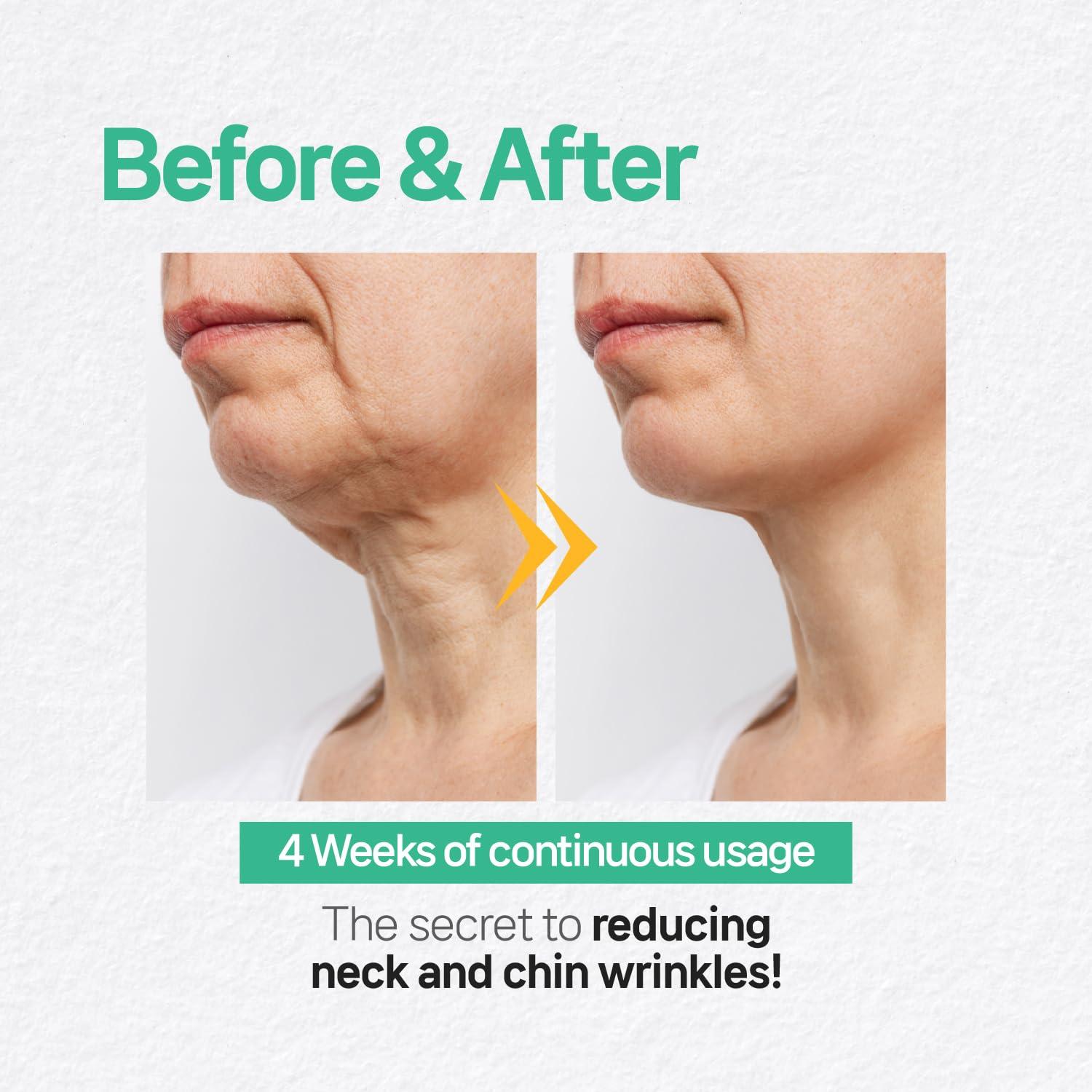 V Line Face Lifting Collagen Sleeping Mask 4ct – Double Chin Reducer & Neck Wrinkle Patches with Hyaluronic Acid & Vitamin E, Chin Strap Care, Neck Lift Tape Overnight