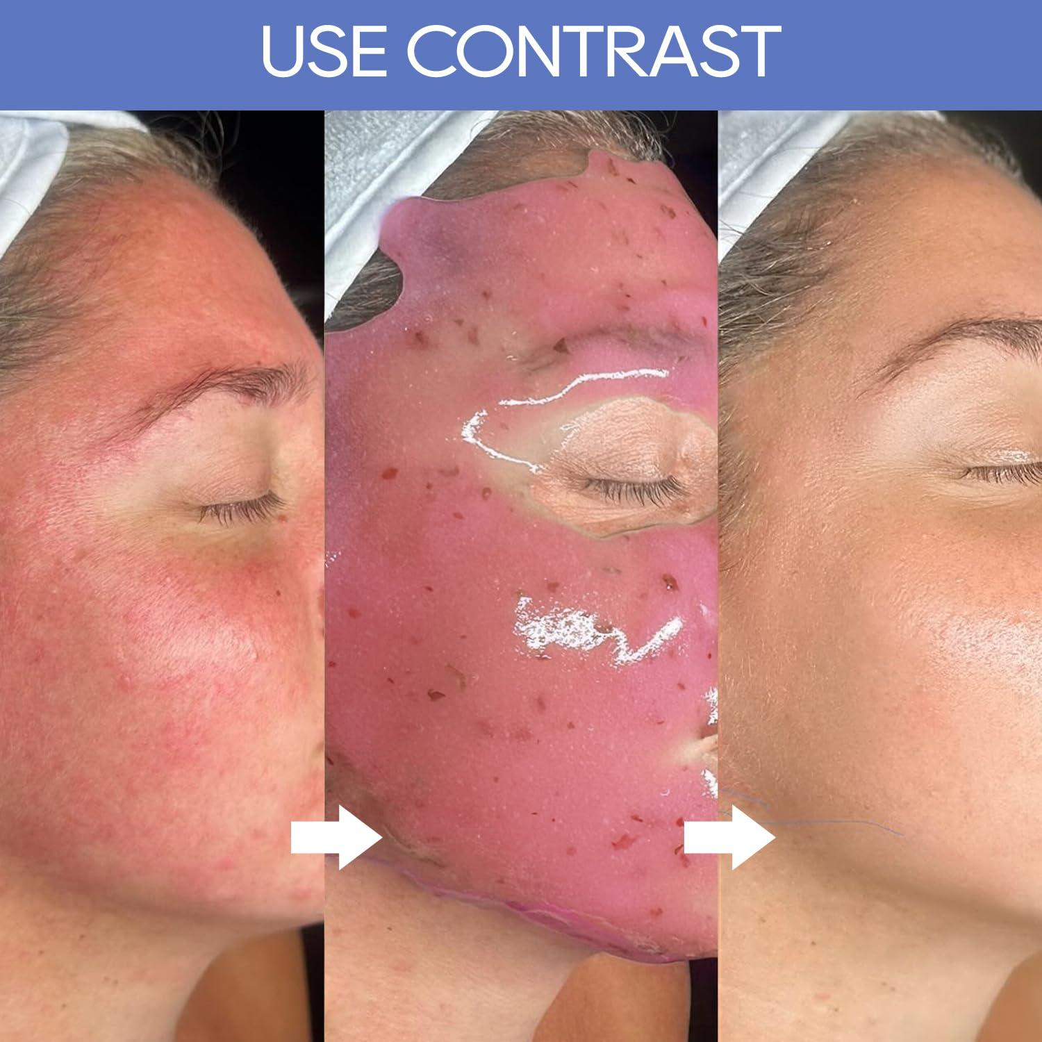 Kit de Mascarillas de Gel KERUILA para Hidratación Facial