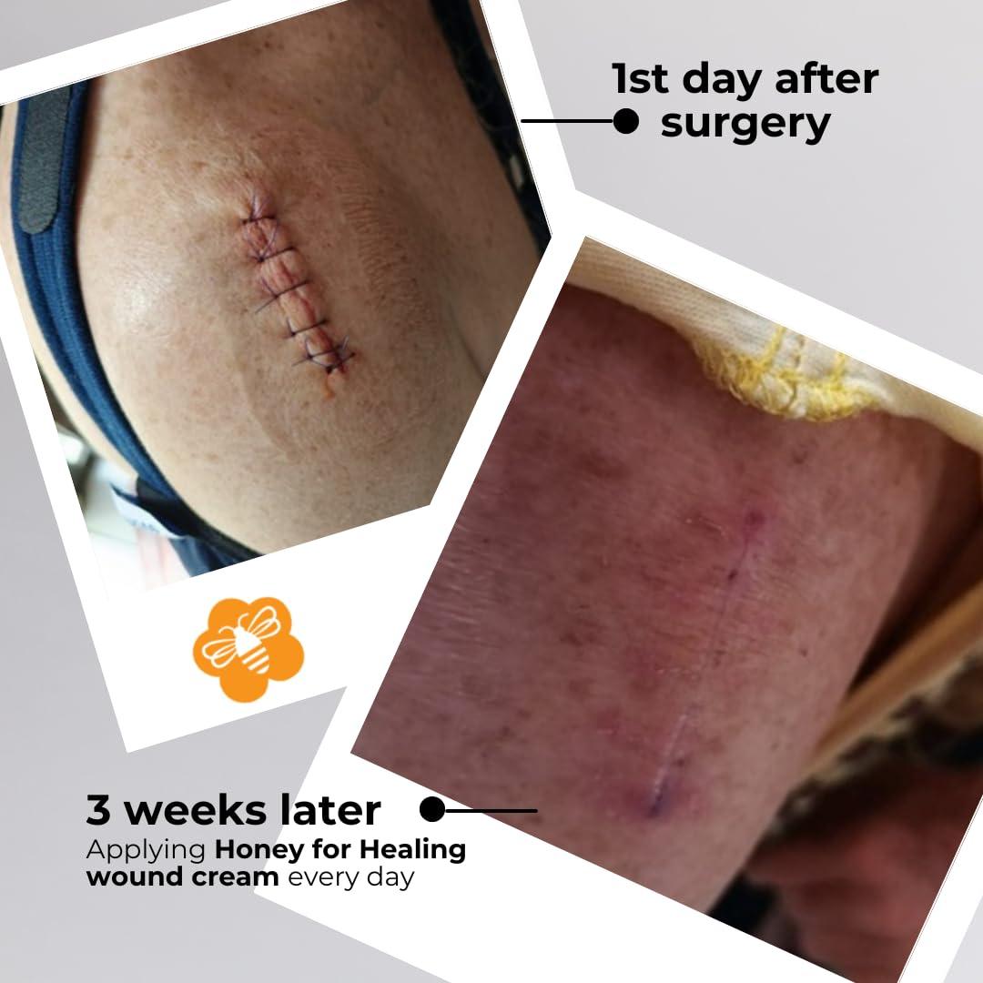 Dúo de Cuidado de Piel Dúo de Piel - Crema Revitalizante y Cuidado de Heridas