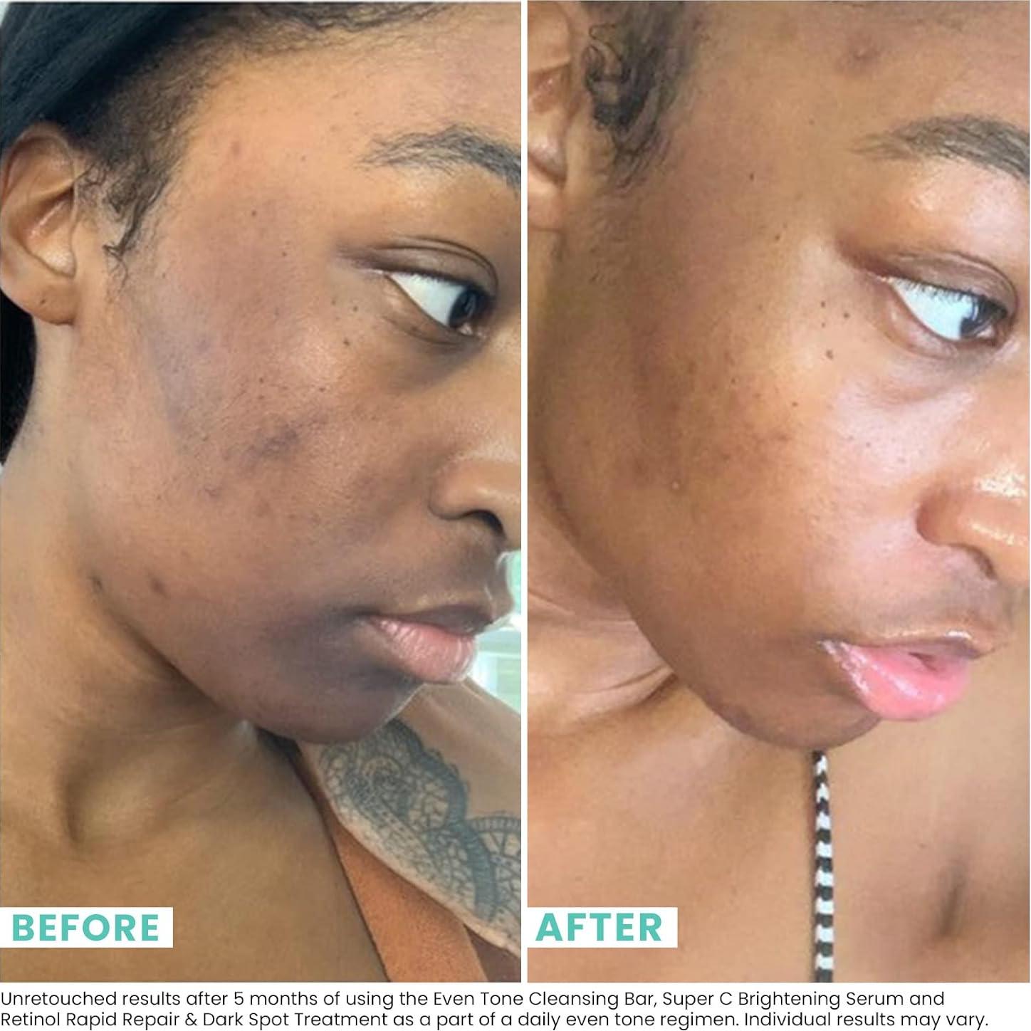 Barra Limpiadora 3 en 1 Urban Skin Rx para Piel Mixta 56.7 g