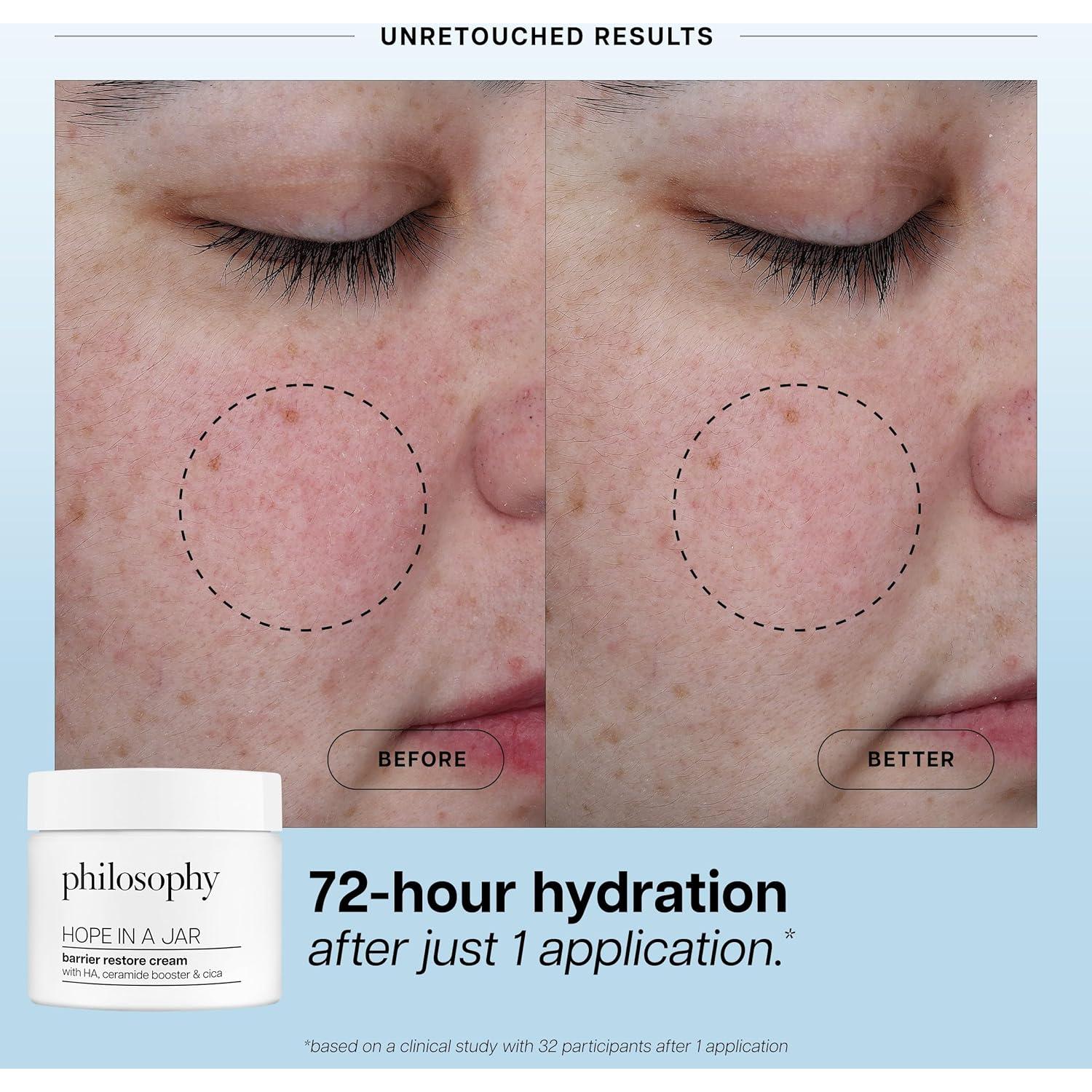 Crema Restauradora de Barrera Philosophy 59 ml - Hidratante para Piel Seca y Sensible