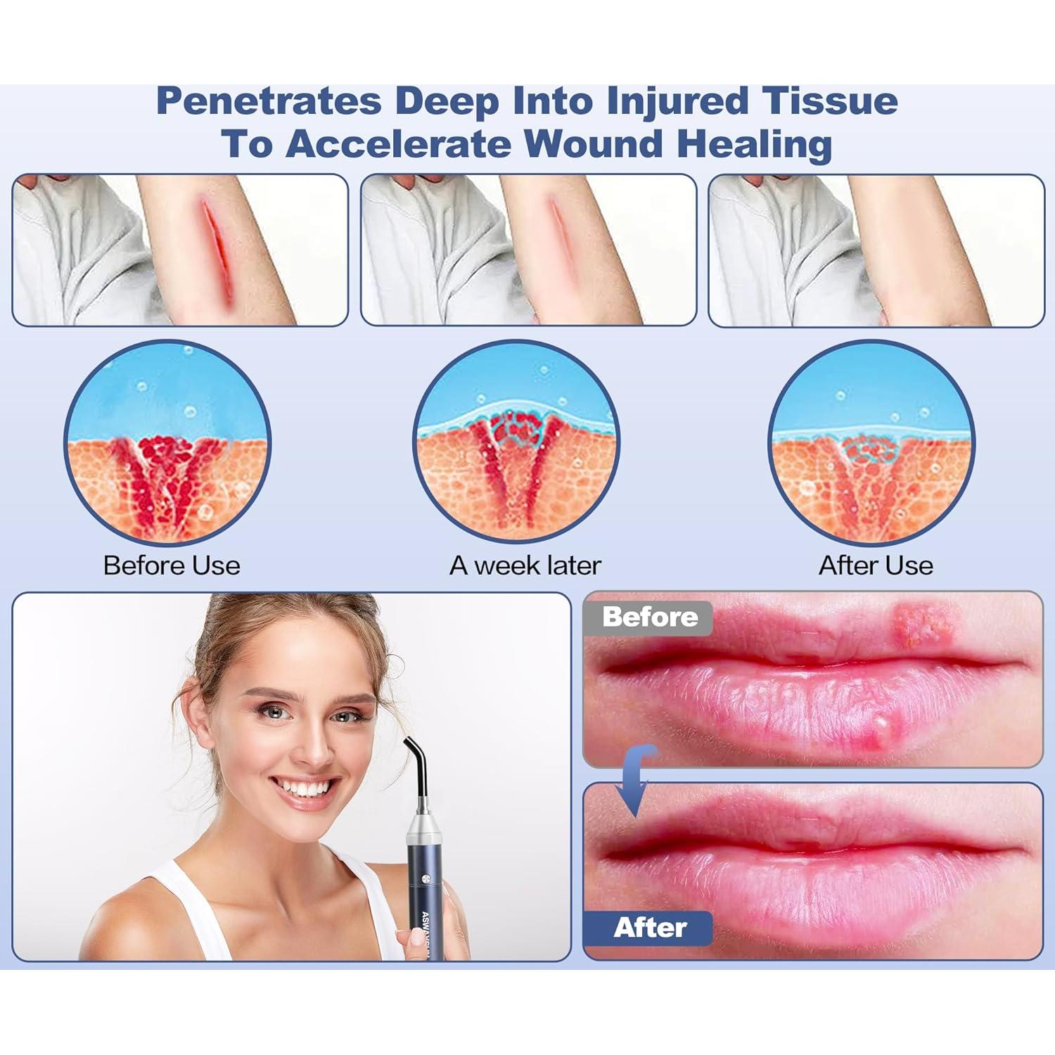 Dispositivo Terapia Luz Roja Aswaysun Alivio Dolor 21x11cm