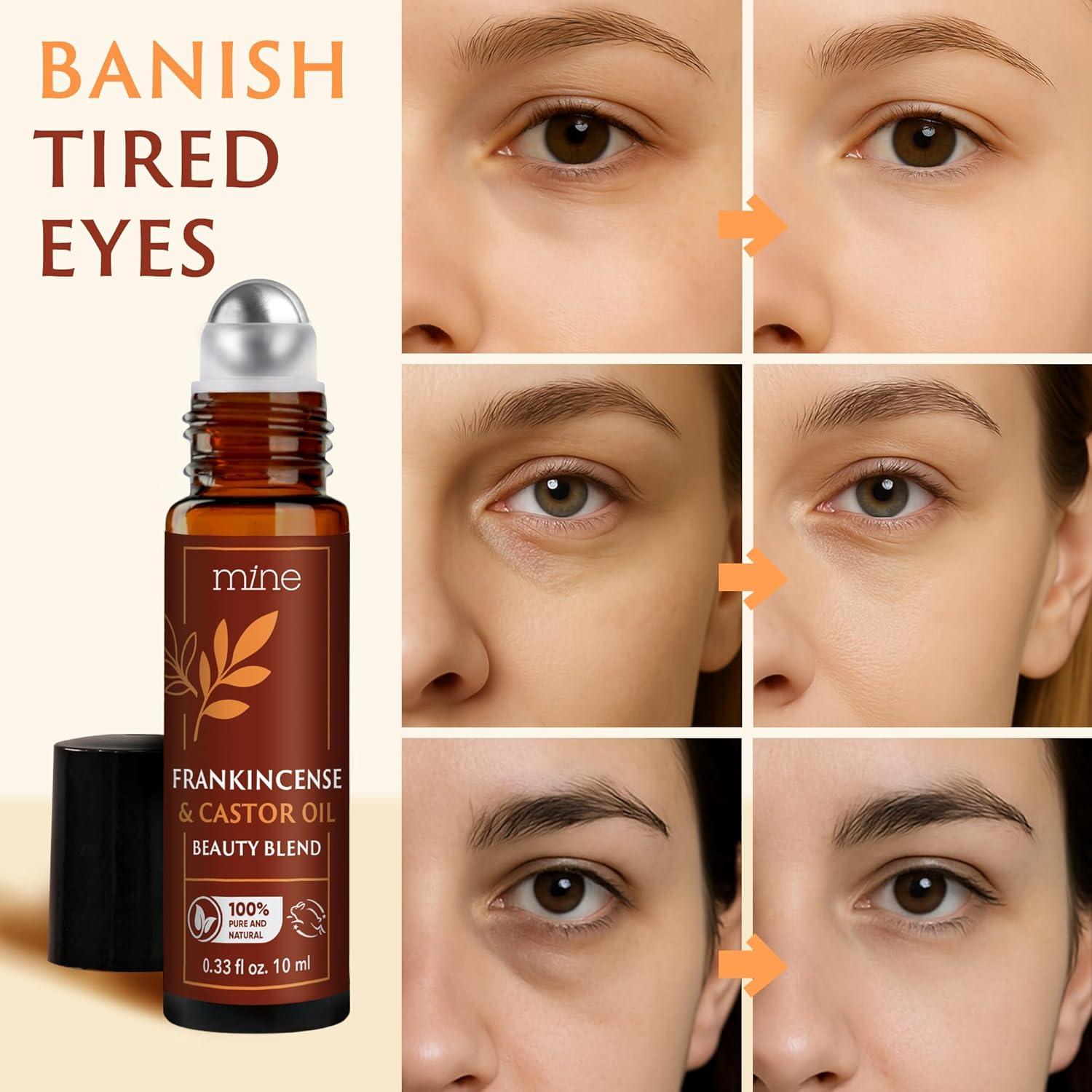 Aceite de Ricino y Incienso Roll On Mine 50g - Hidratante Ojos