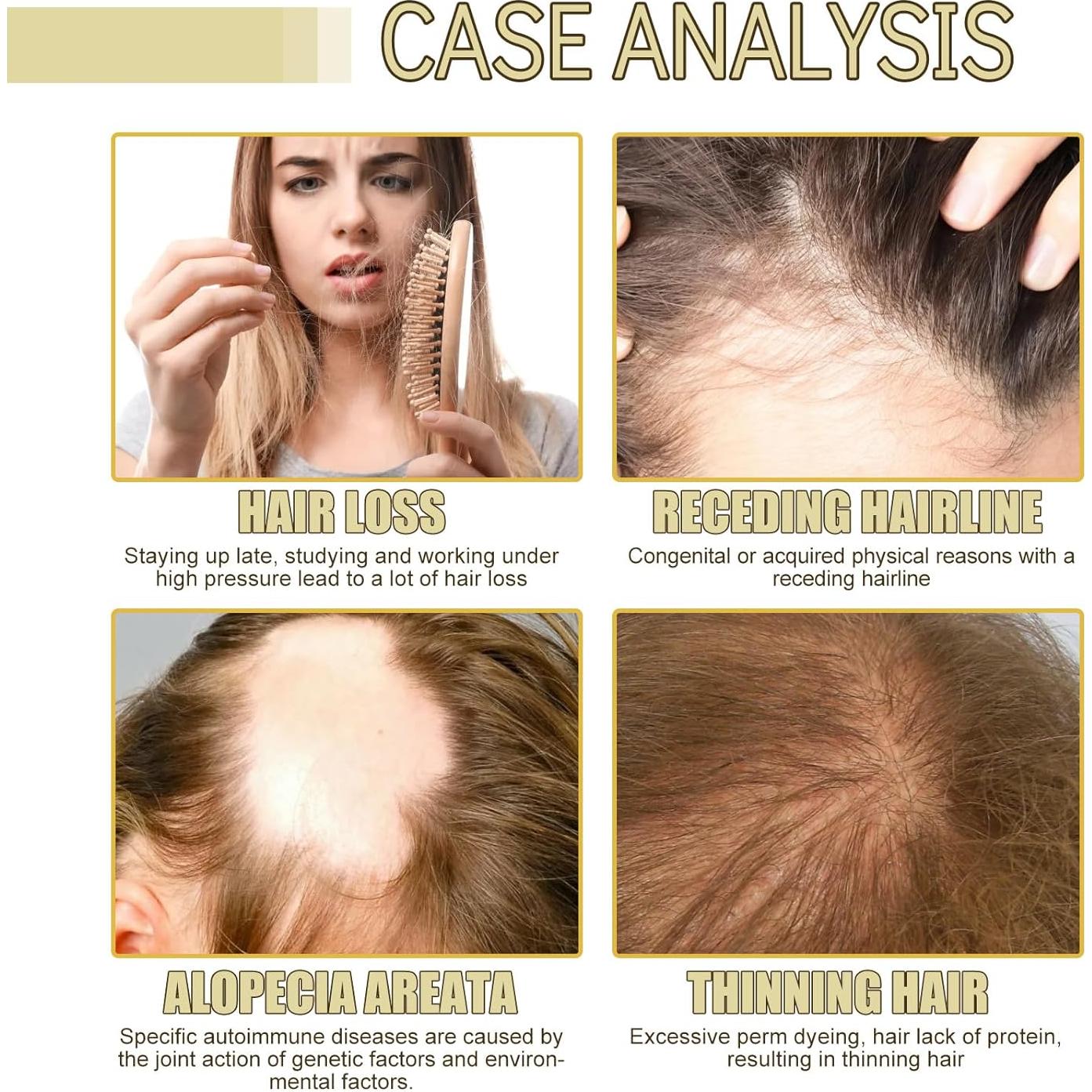 Aceite de Crecimiento Capilar Eelhoe 180ml Orgánico Romero