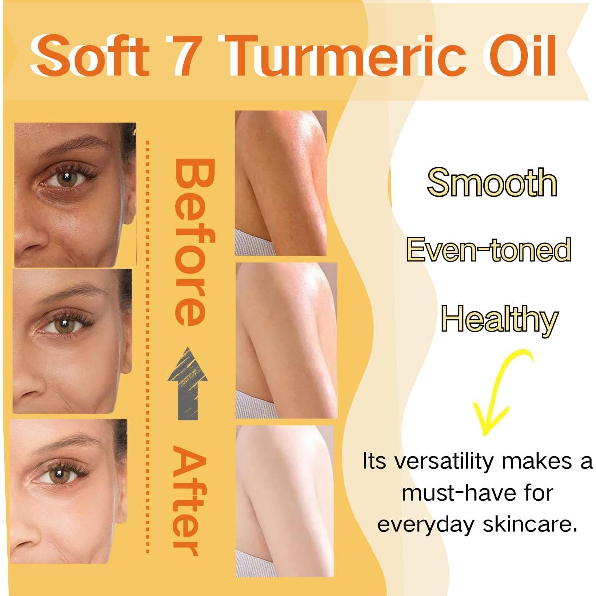 Aceite Corporal de Cúrcuma Soft 7 - Hidratante y Suavizante