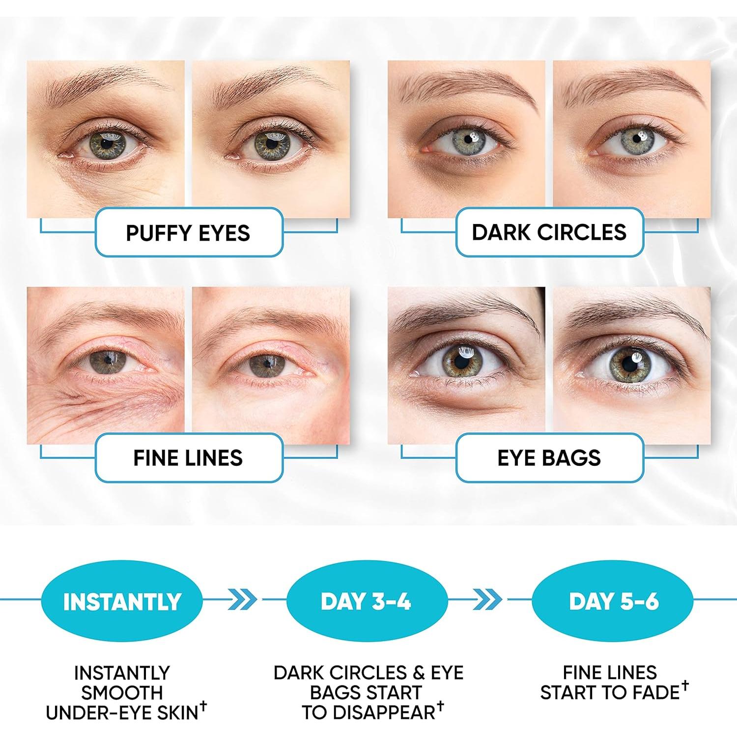 Parche para Ojos Lorelis Lab 30 Pares Hidratantes