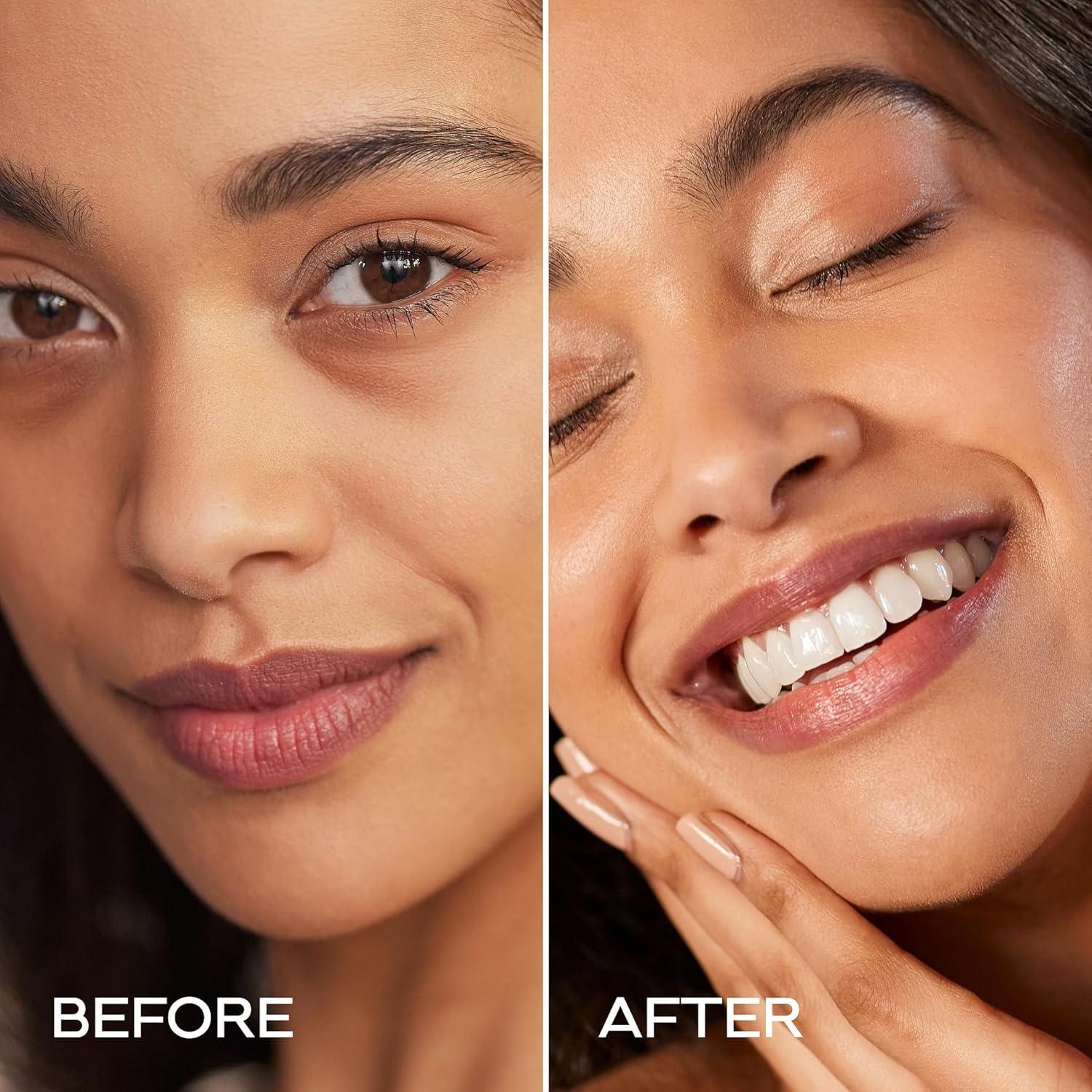 Parche Hidrogel Azul KINPUR 30 Pares - Ácido Hialurónico y Colágeno