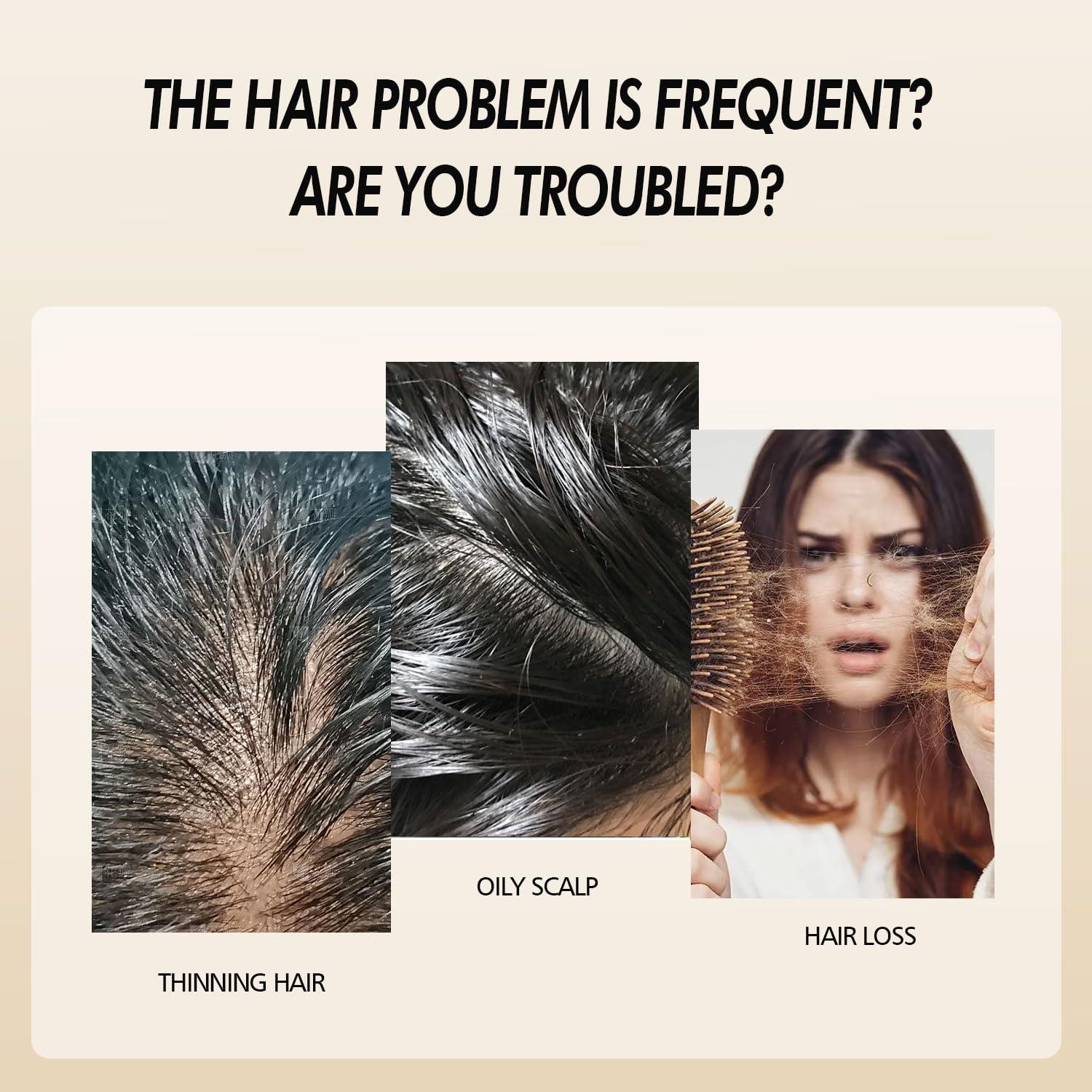 Spray Crecimiento Cabello Lanthome 29.57 ml Unisex Romero Cebolla