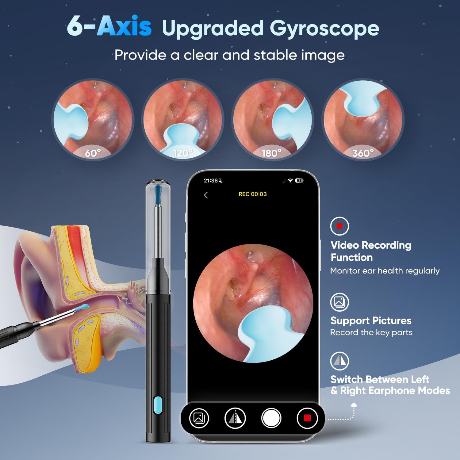 Kit Eliminación de Cerumen MOOPHY con Cámara 1296P y 6 Luces LED