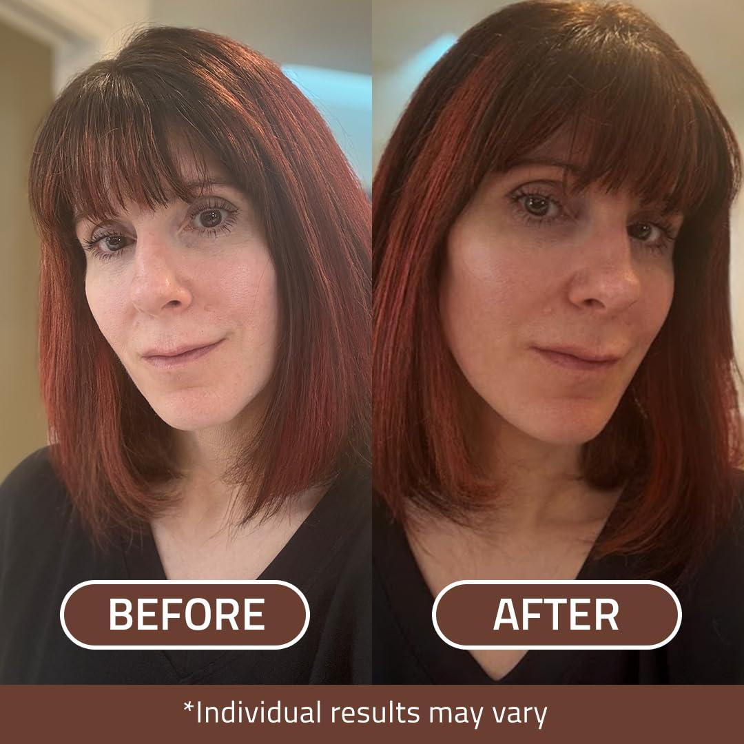 Gotas de Bronceado Facial YEOUTH 30ml - Personalizables y Sin Olor