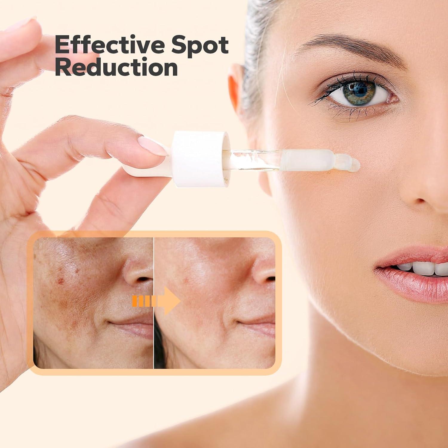 Suero Corrector de Manchas Oscuras SilkySecret 30 ml Niacinamida