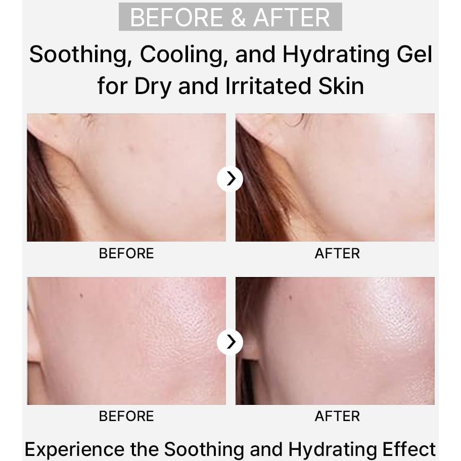 Gel Hidratante Rejuvenecedor ARZTIN con Aloe Vera 167g