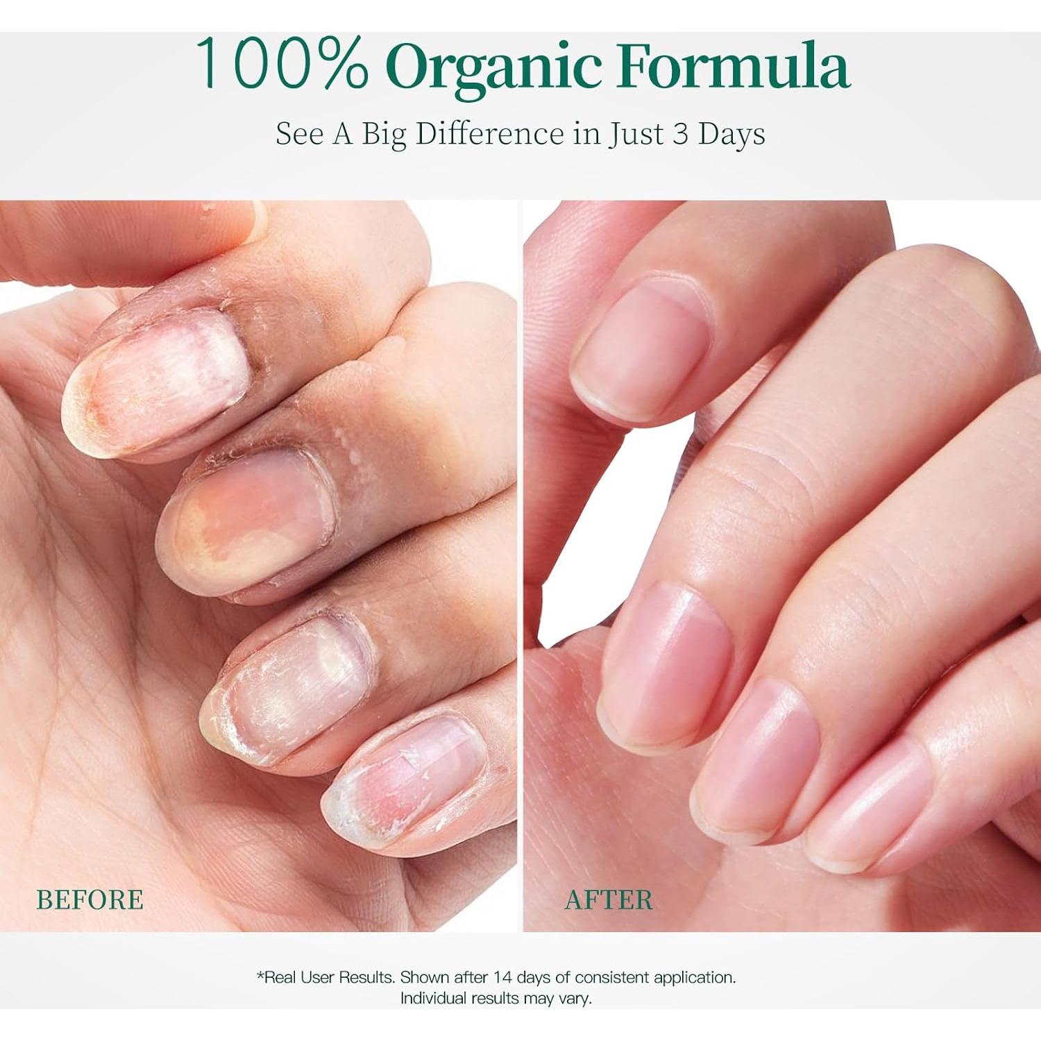 Aceite para Cutículas Apuree 30ml - Hidratación Profunda Vegano