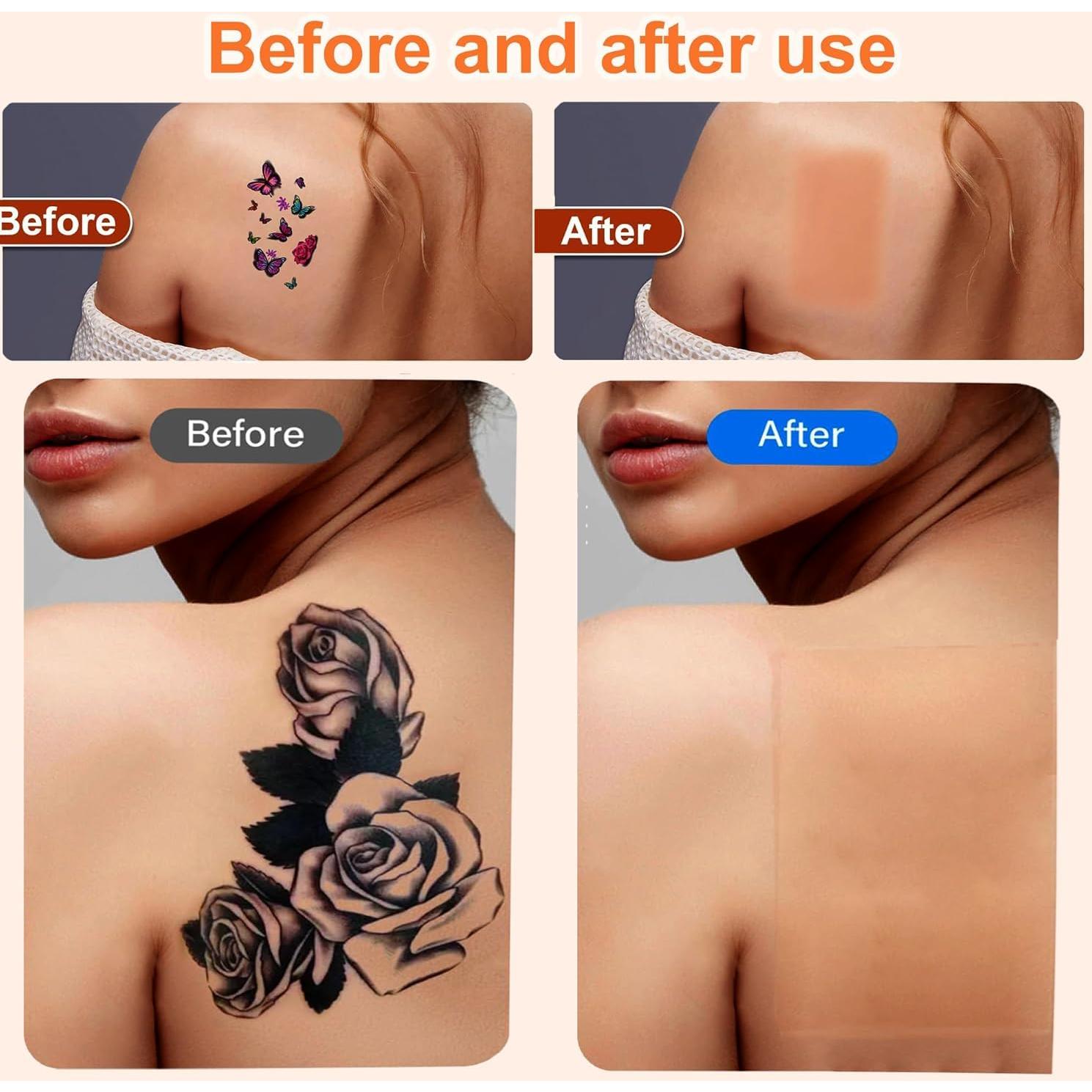 Parche Cubridor de Tatuajes Zhenlang 15 Pcs Piel Oscura 11.94x7.49cm