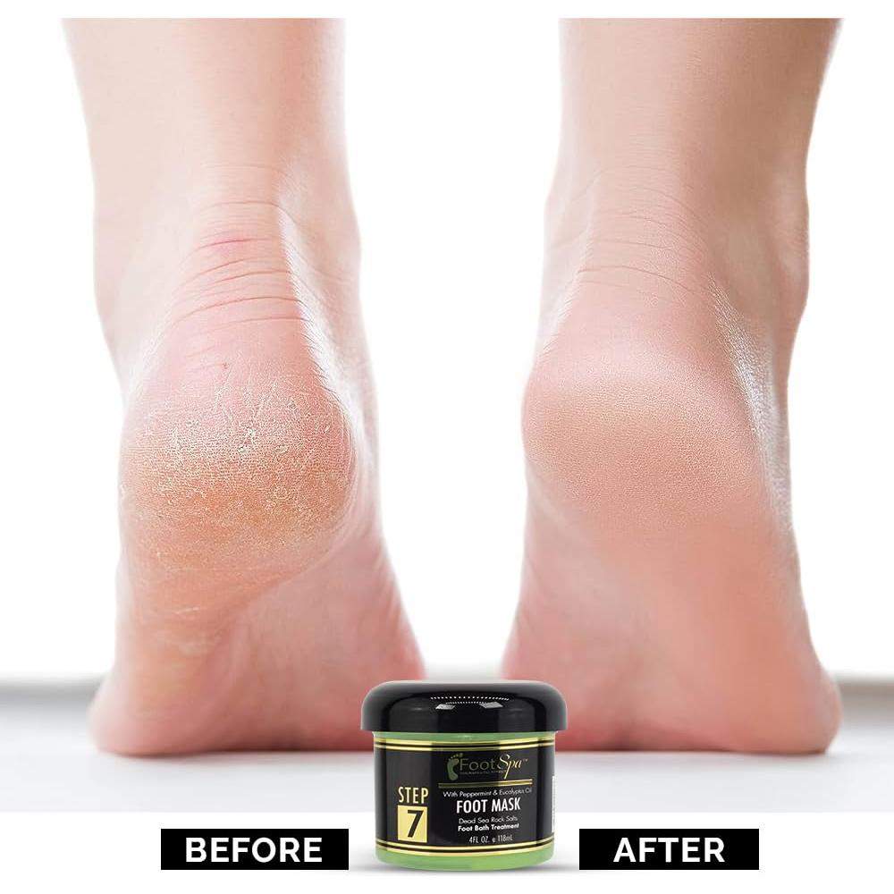 Mascarilla Crema para Pies Chemco 113.4 g con Menta y Eucalipto