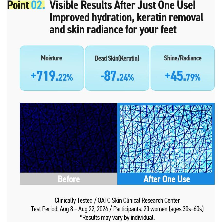 Mascarilla Hidratante para Pies FRMADCOS - 5 Pares Aceite de Coco