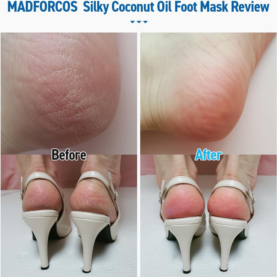 Mascarilla Hidratante para Pies FRMADCOS - 5 Pares Aceite de Coco