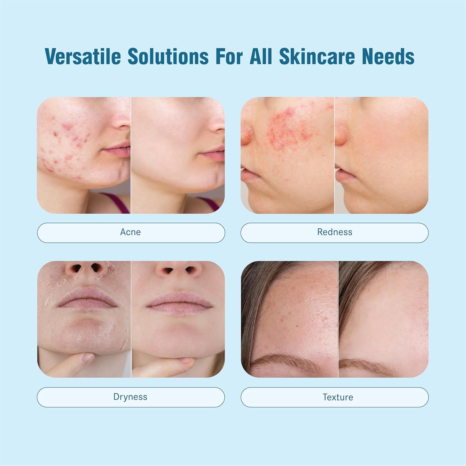 Kit de Cuidado de Piel HOCL - Limpiador Multiusos 236ml y Bruma Facial 59ml