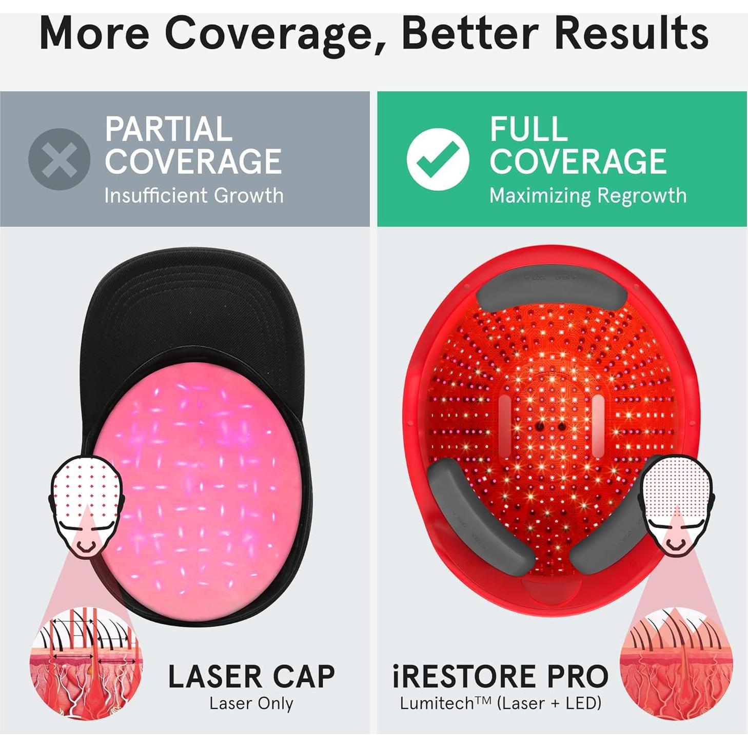 iRestore Pro Gorro Terapia Luz Roja 282 Lásers Crecimiento Cabello