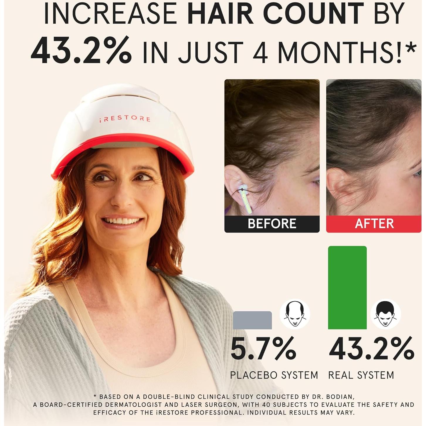 iRestore Pro Gorro Terapia Luz Roja 282 Lásers Crecimiento Cabello