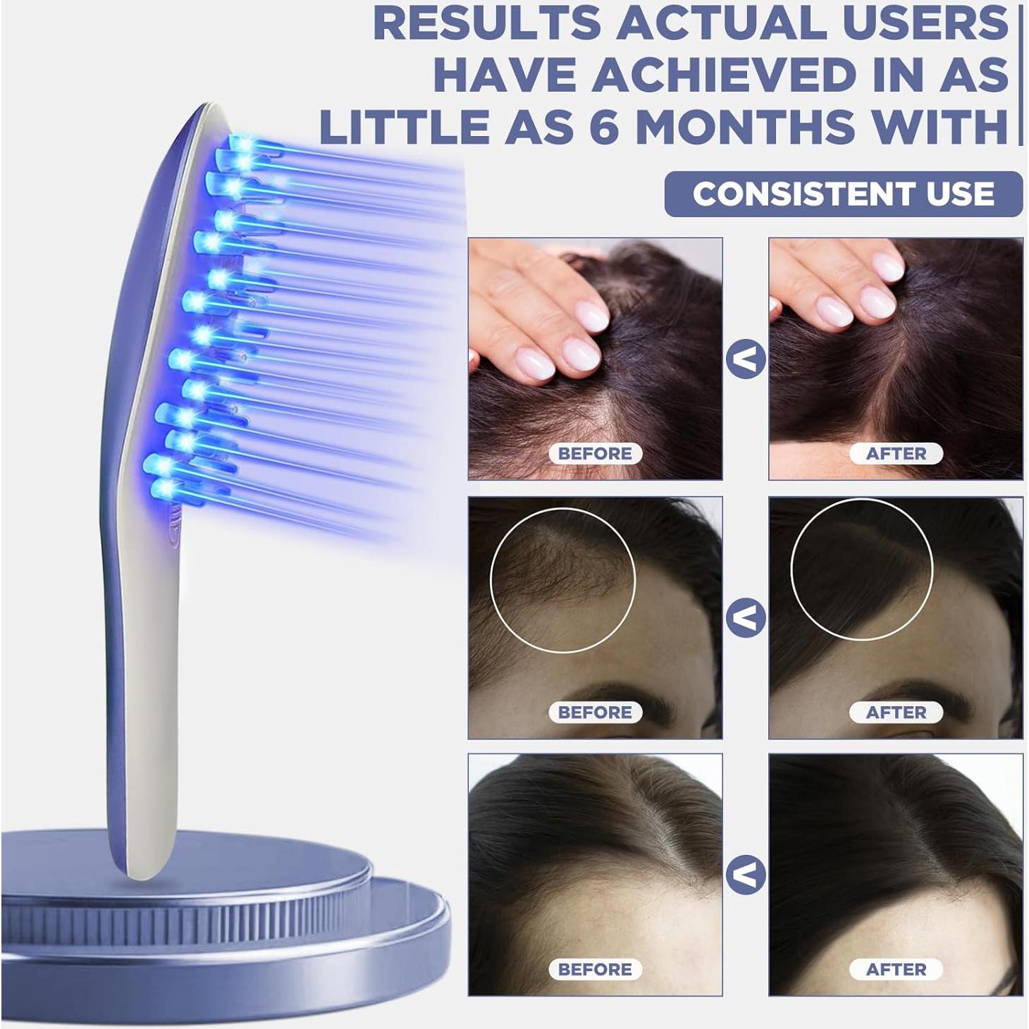 Peine Terapia Láser Tkcsoi Lasercomb-001 Crecimiento Cabello