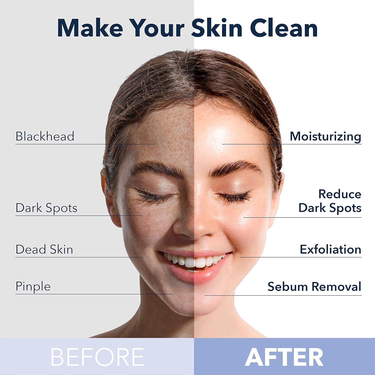 Mascarilla Burbujeante Purederm Rosa O2 Durazno - 5 Pzas