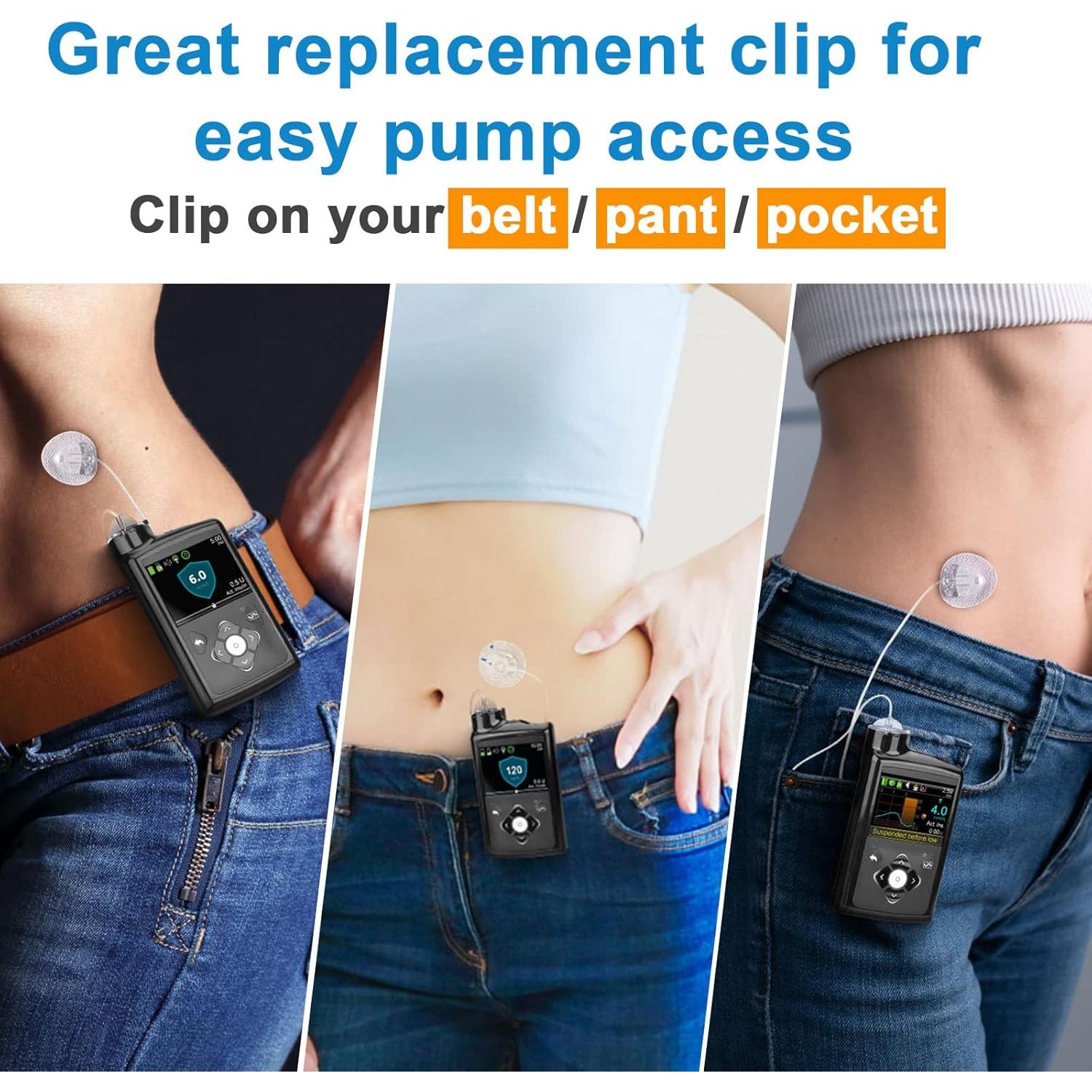 Clip de Bomba de Insulina iGuerburn para Medtronic MiniMed 630G 640G 670G 770G 780G - Negro