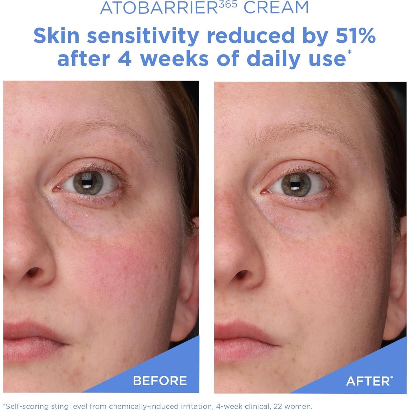 Crema Aestura Atobarrier365 80 mL Hidratante Piel Sensible