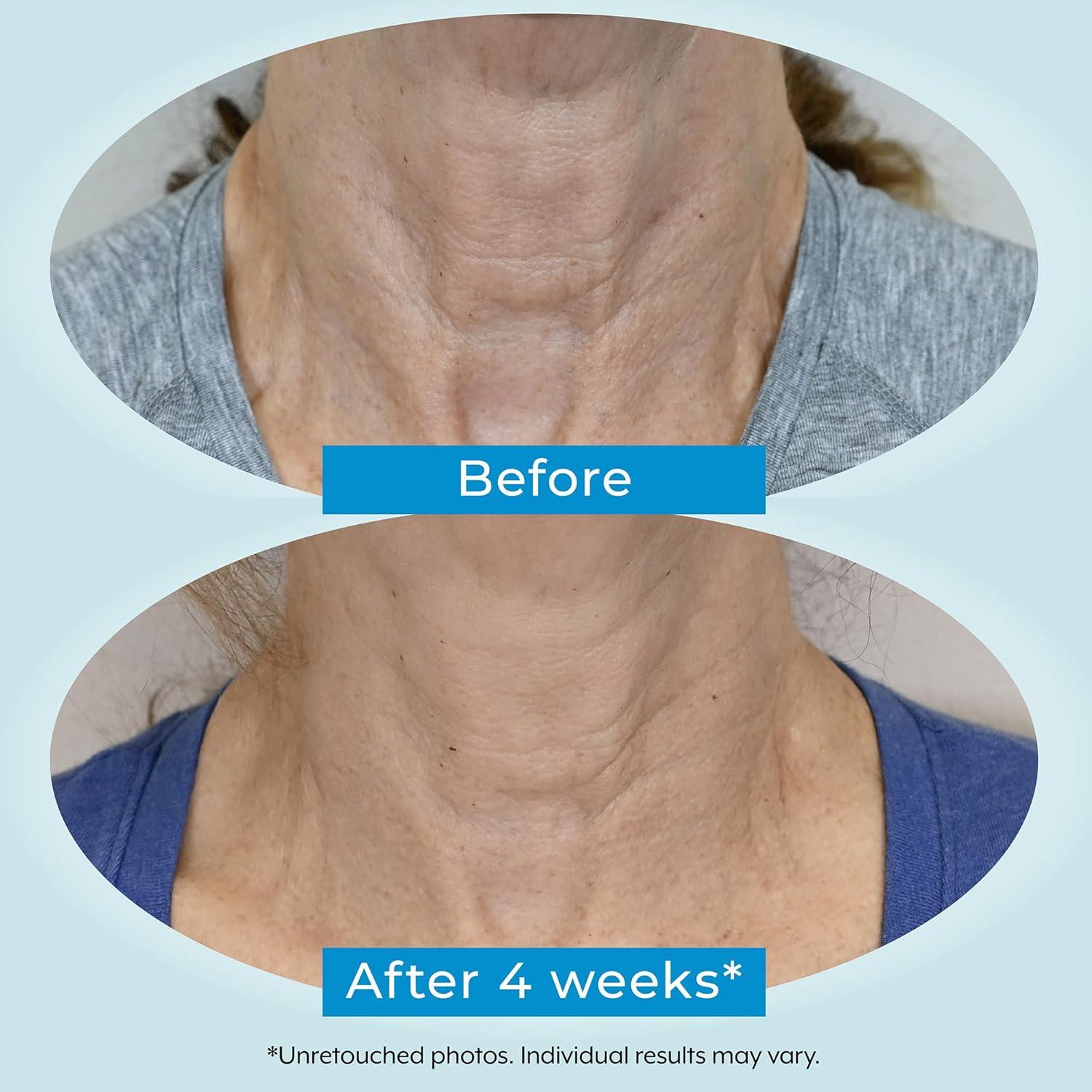 Crema Facial Plexaderm 1% Retinol Antiarrugas 50 ml