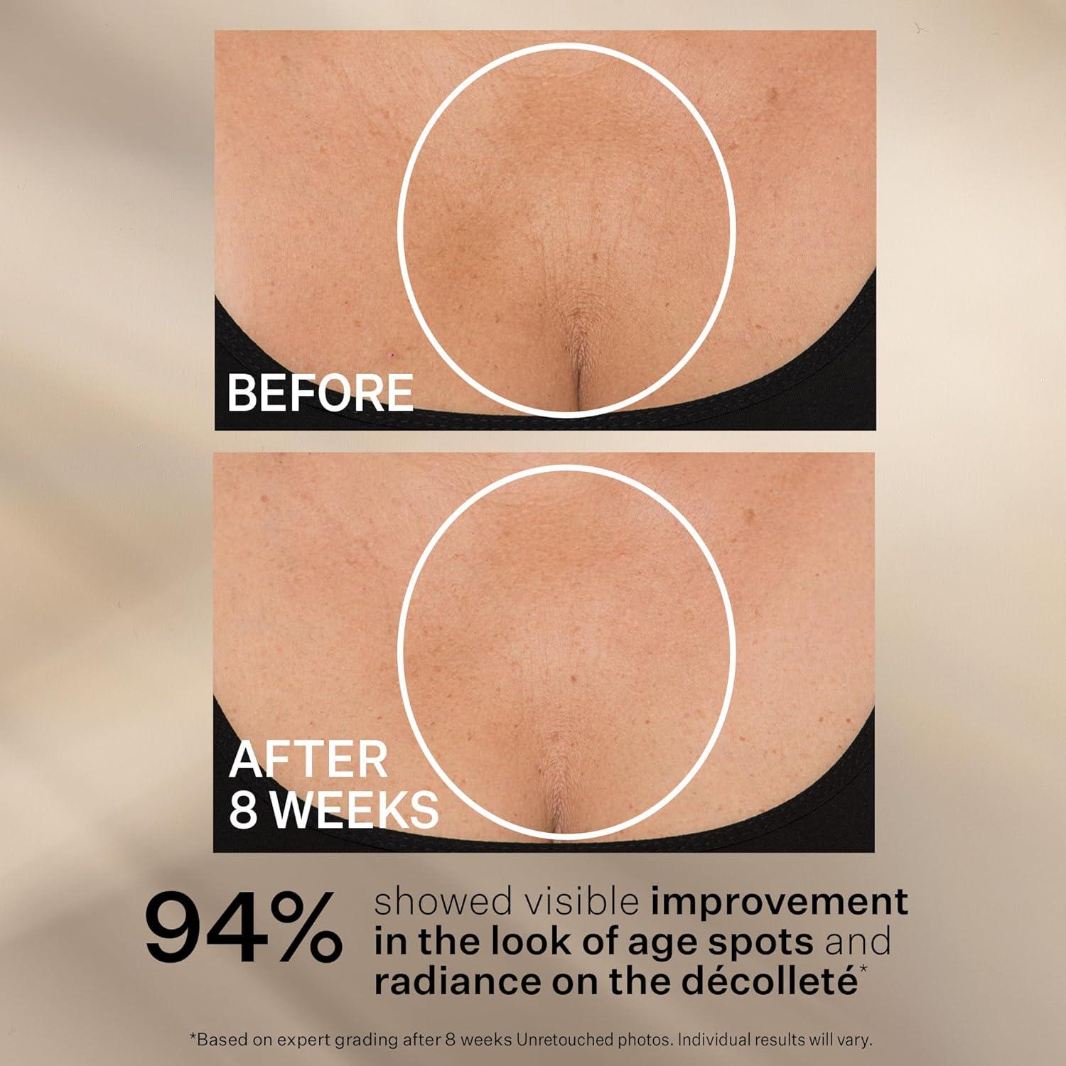 Crema para Cuello StriVectin Tighten & Lift 113g Péptidos